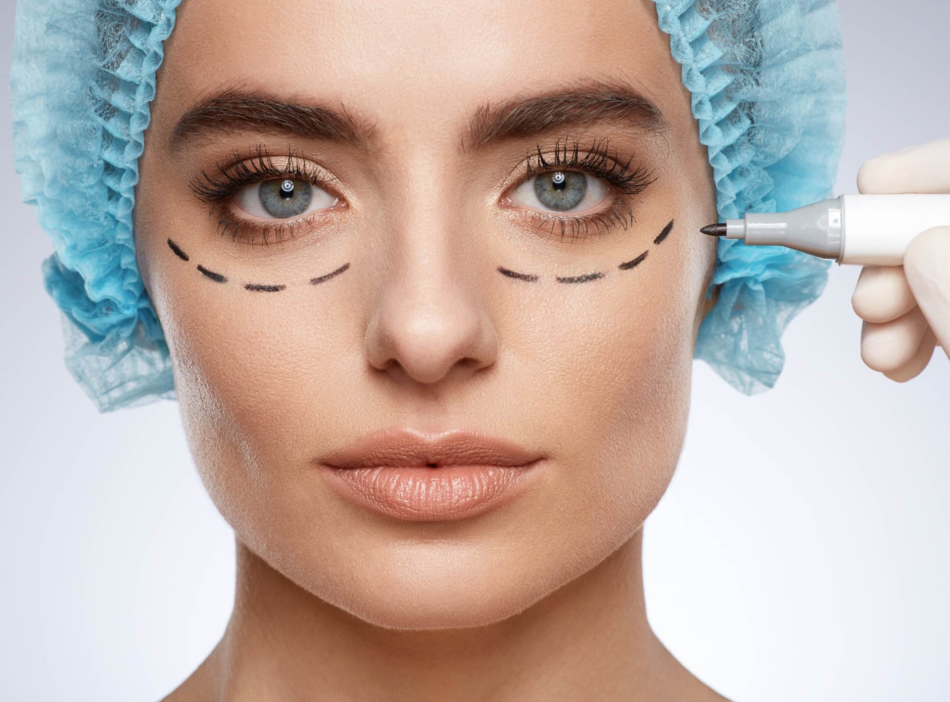 How to Prepare for Eyelid Surgery