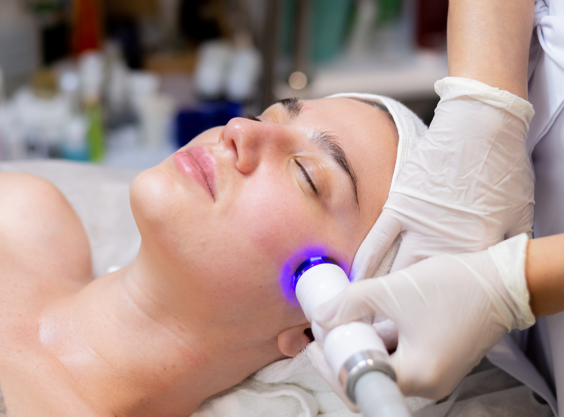 Ipl Treatment Side Effects