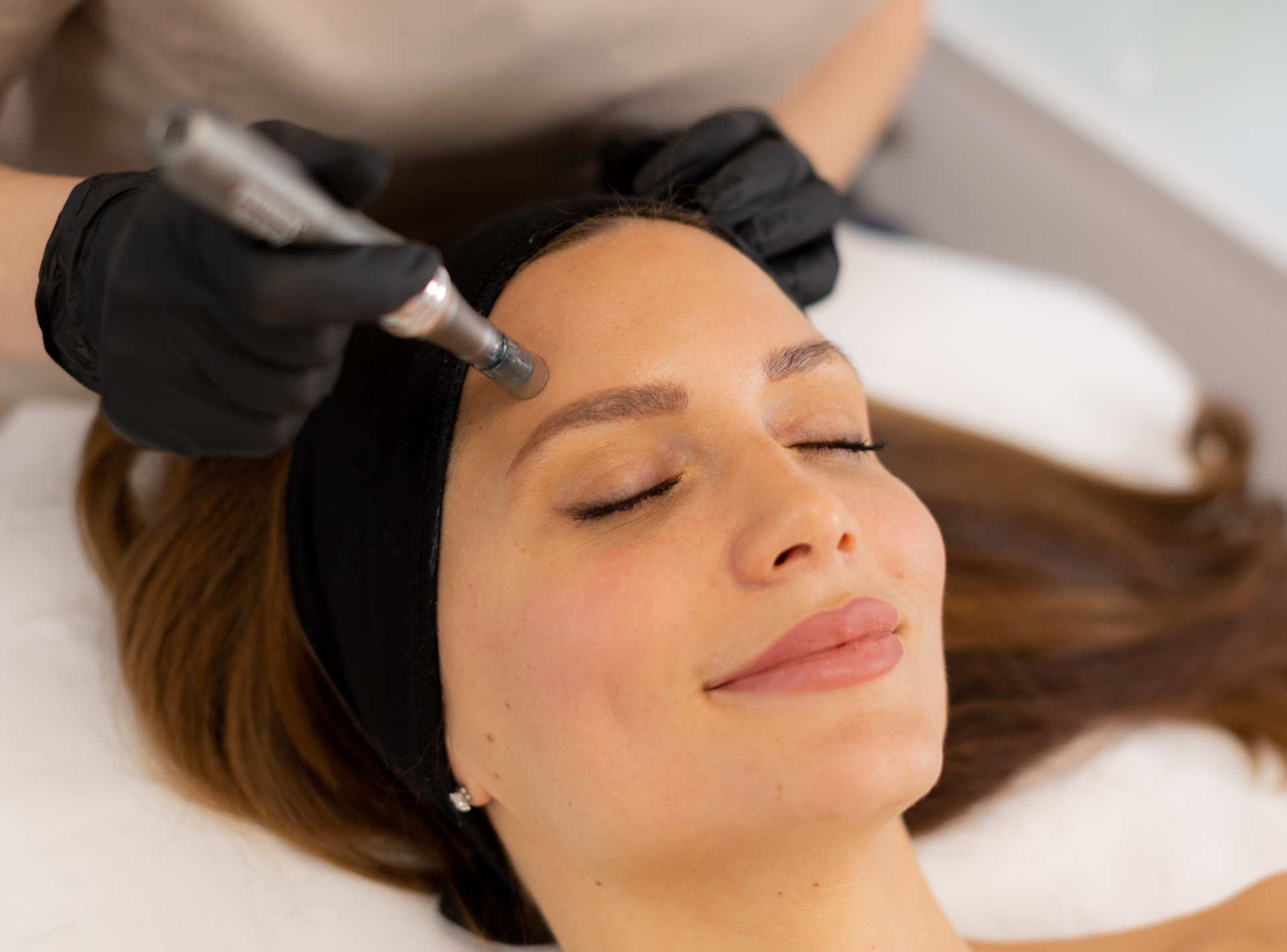 How to Prepare for Your Microneedling Session?