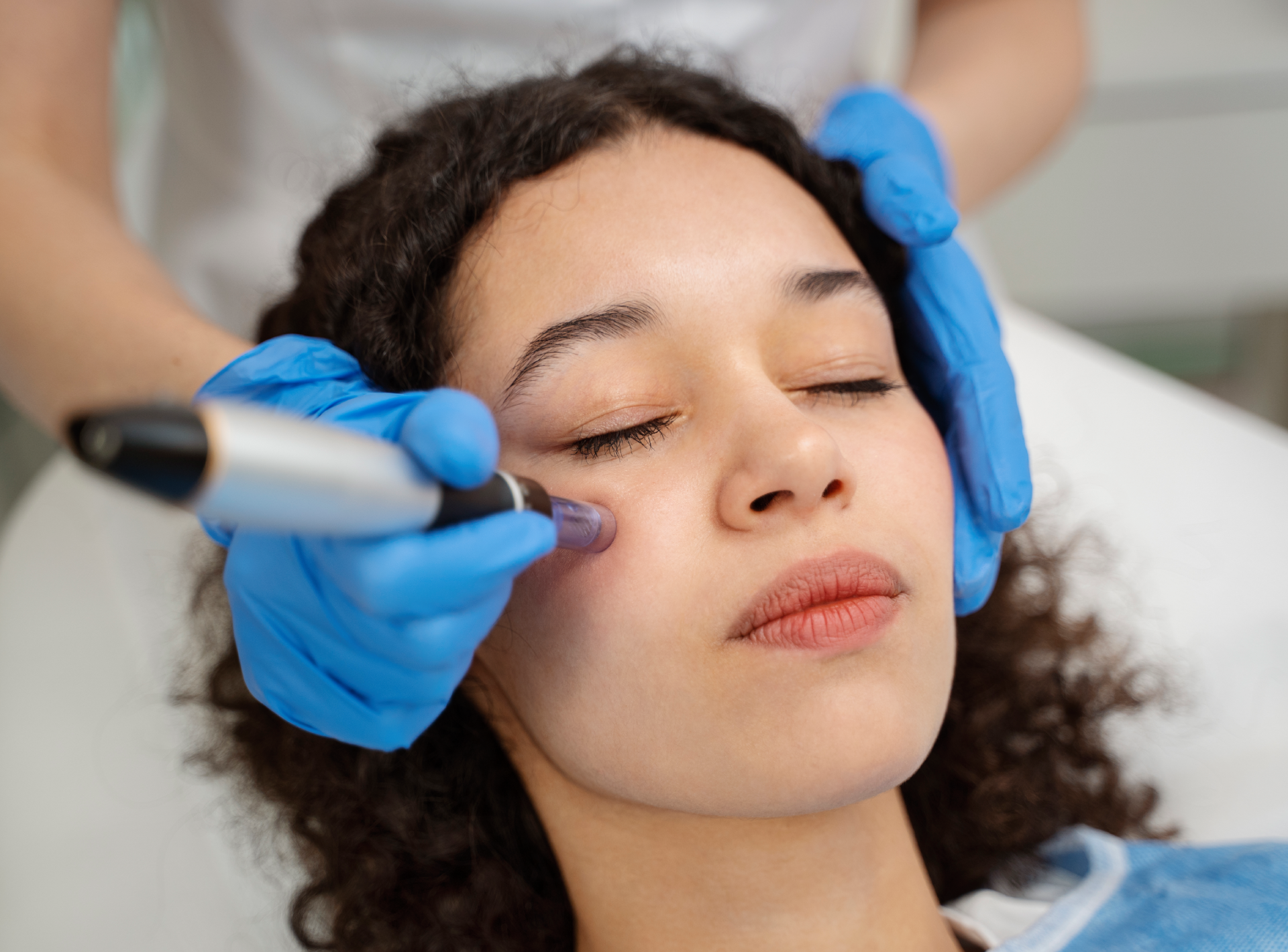 8 Common Questions About Microneedling