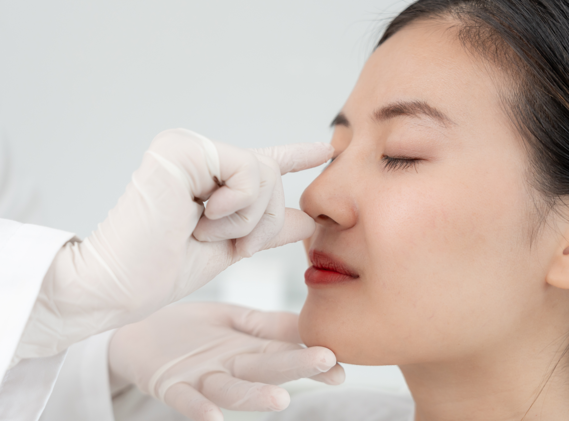 Open or Closed Rhinoplasty: Which is Right for Me?