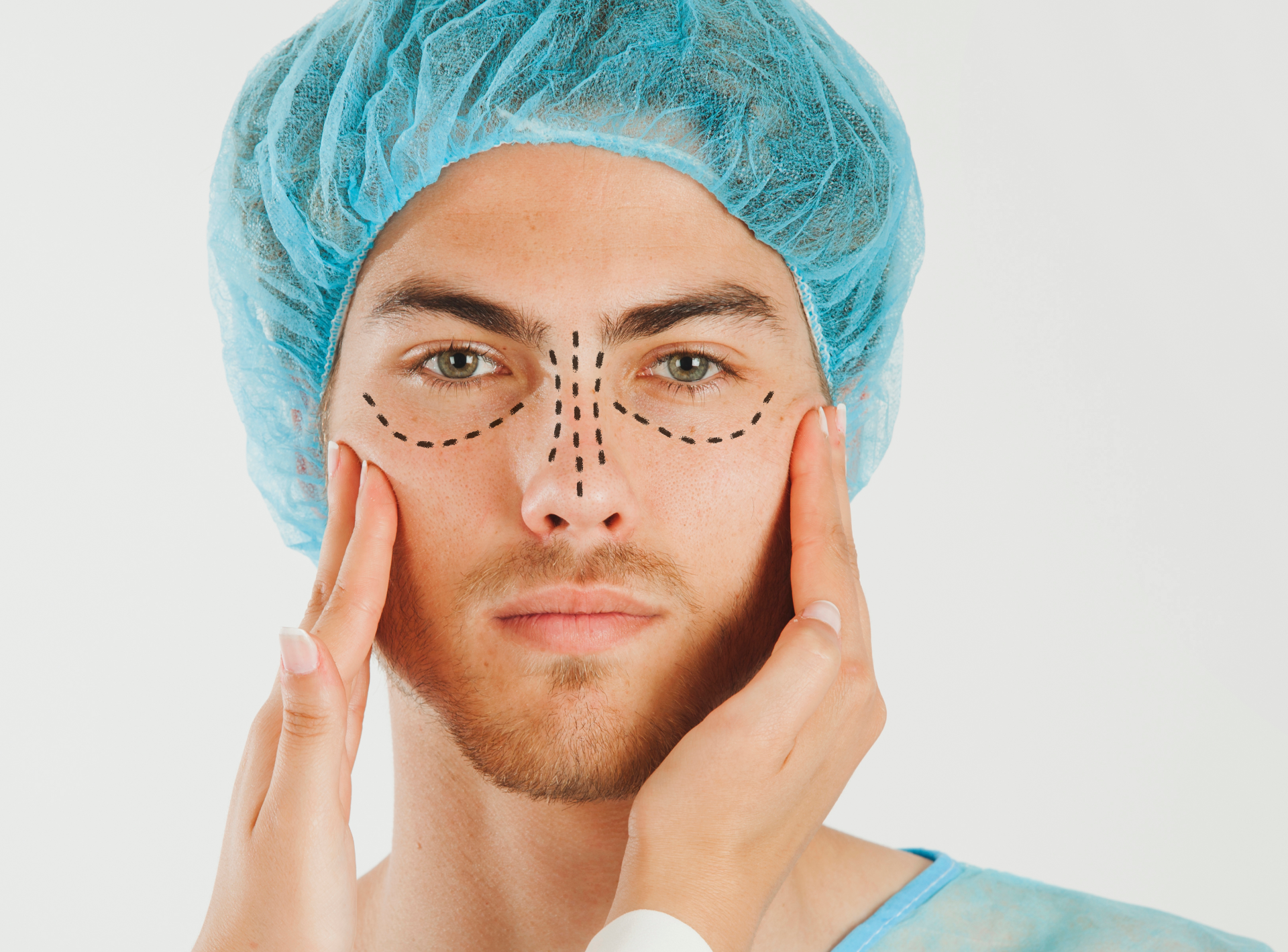 Rhinoplasty for International Patients