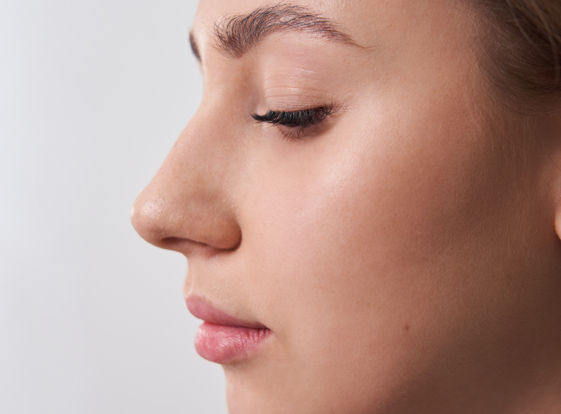 Surgical Rhinoplasty Gone Wrong: Causes, Complications and Your Options to Correct It