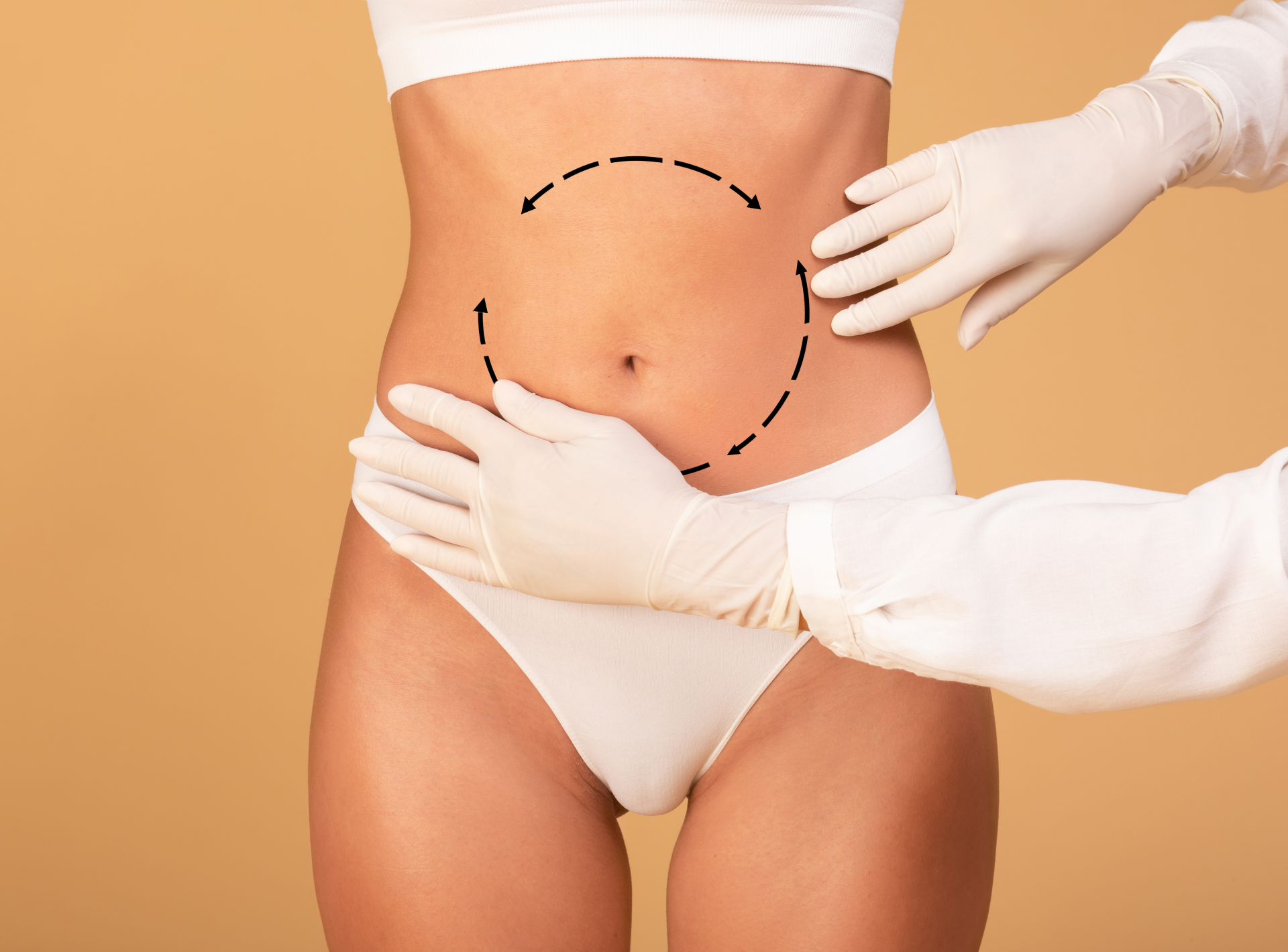 360 Liposuction and Tummy Tuck Surgery