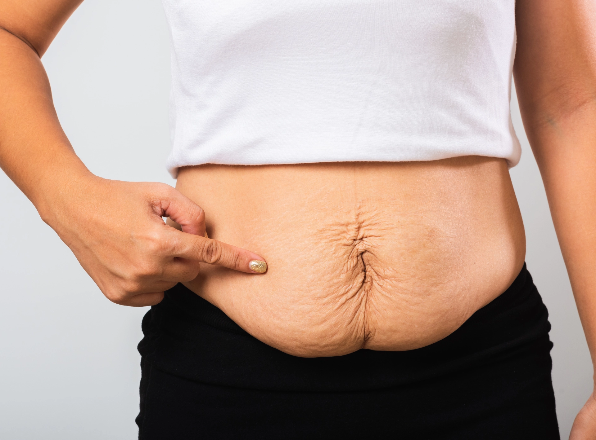 is Tummy Tuck Surgery Safe?