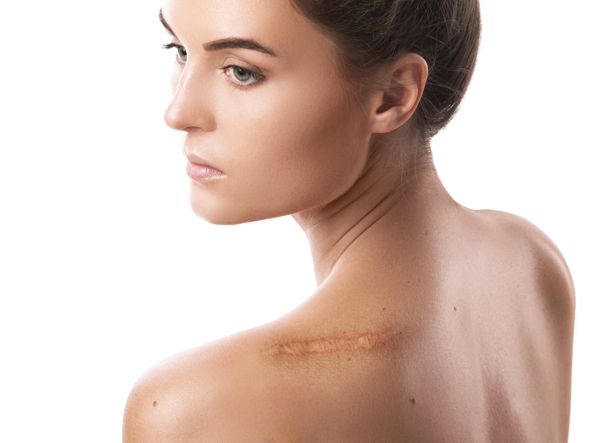 Types of Scars_ Causes and Reduction