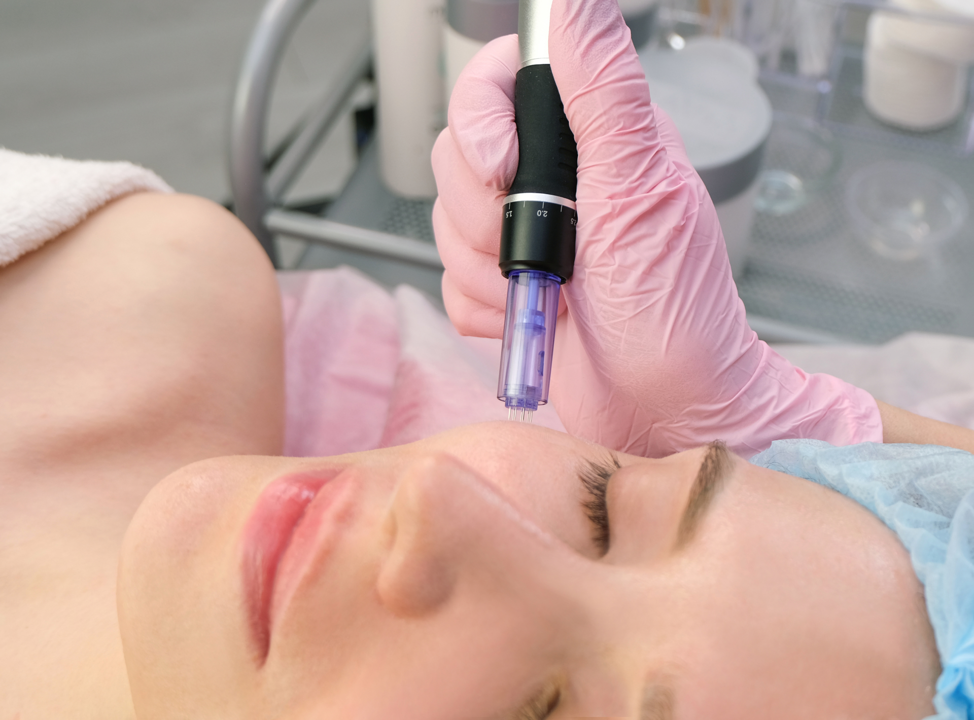 Unlocking the Secrets of Microneedling