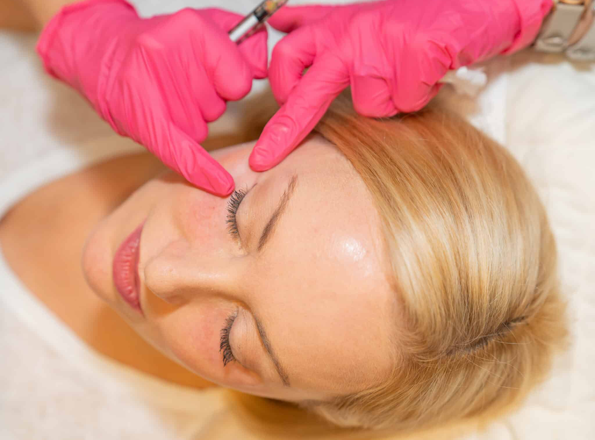 Vampire Facial Recovery Time