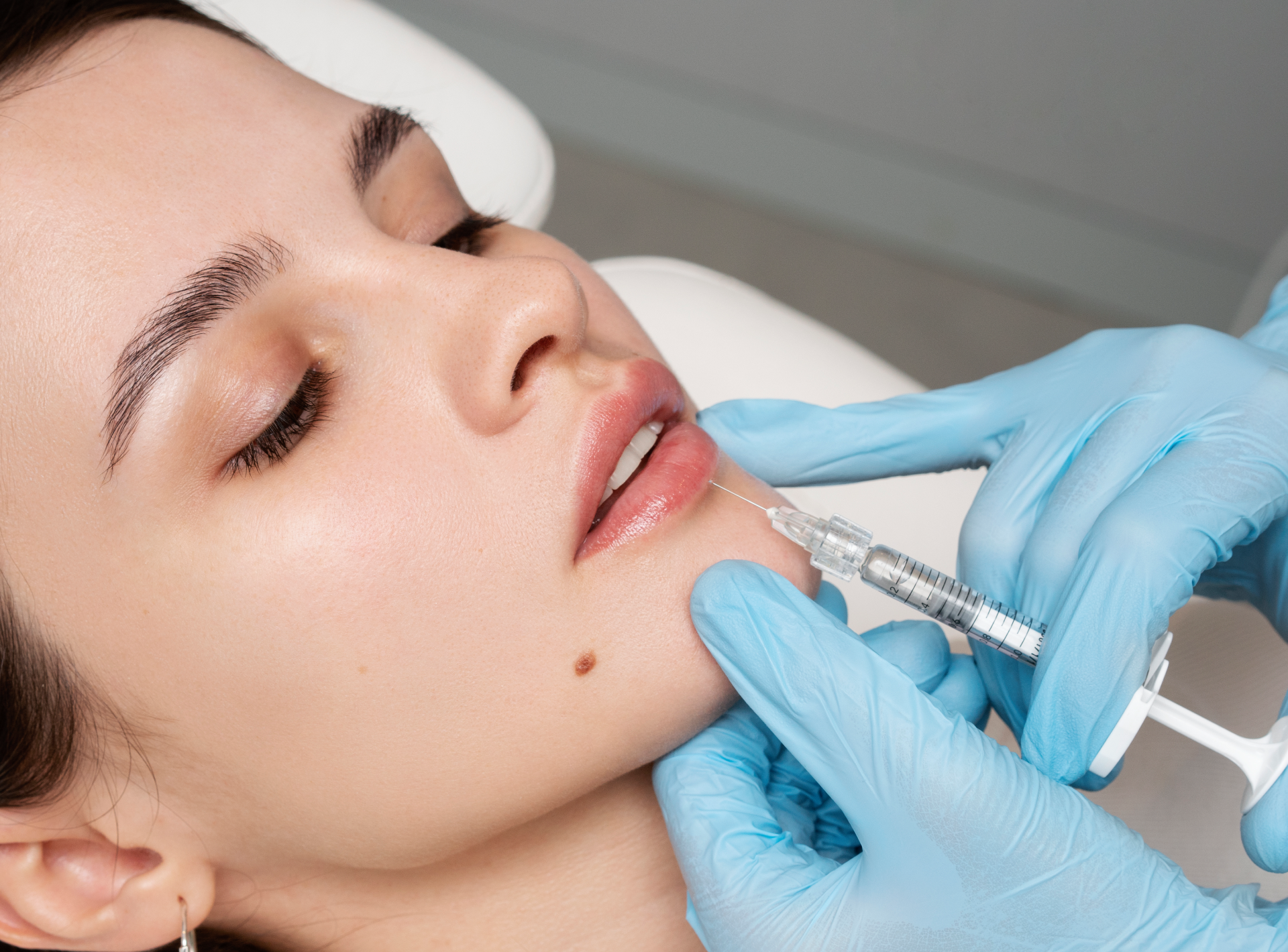 Where to Go for Lip Fillers