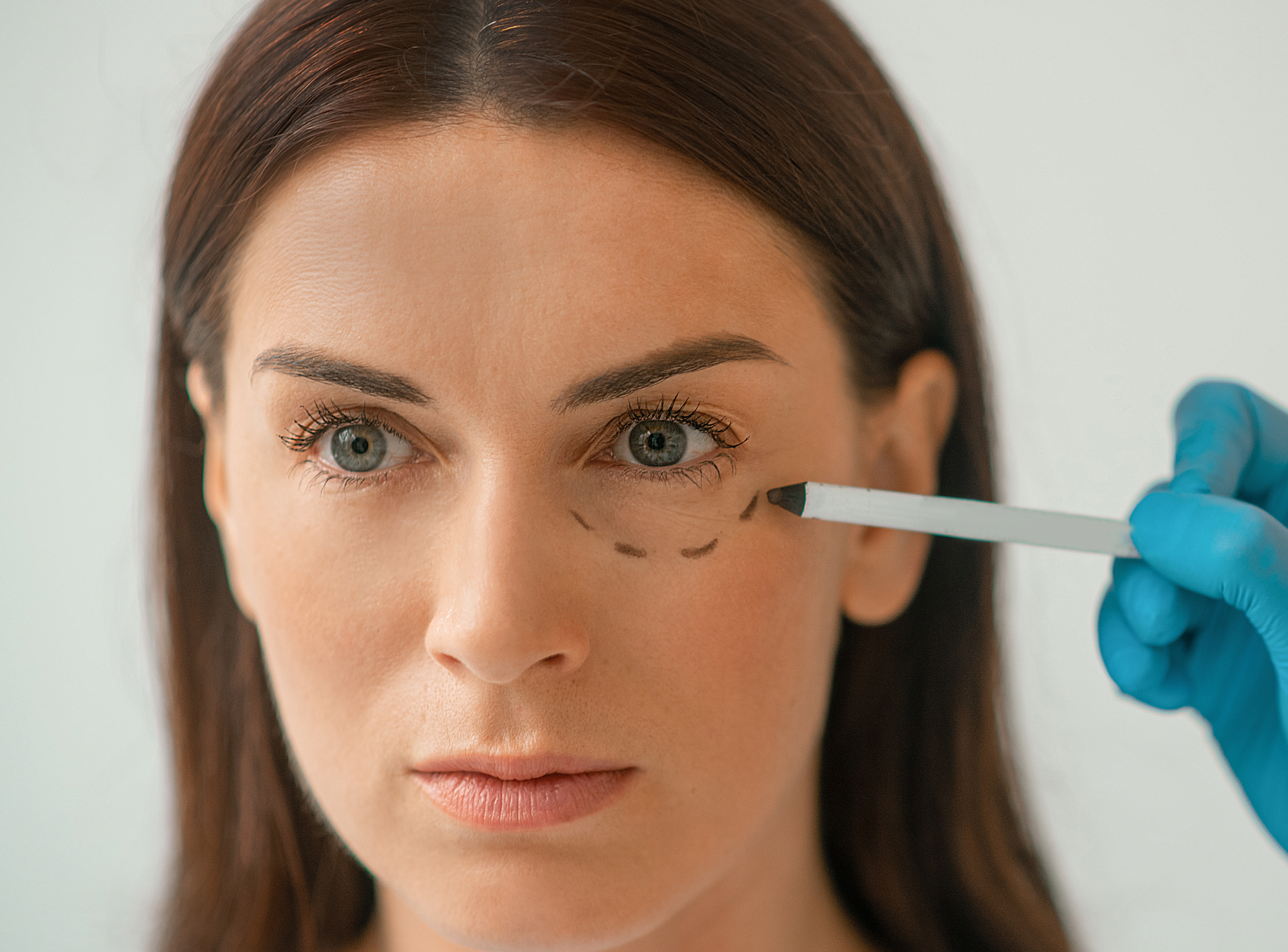Before a Blepharoplasty for Safe Results