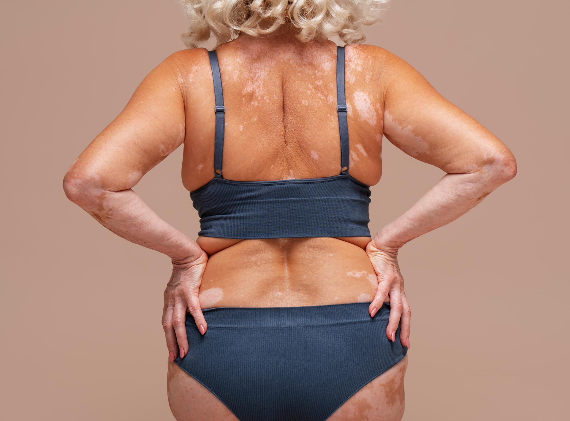 Bra-line Back Lift Recovery Tips