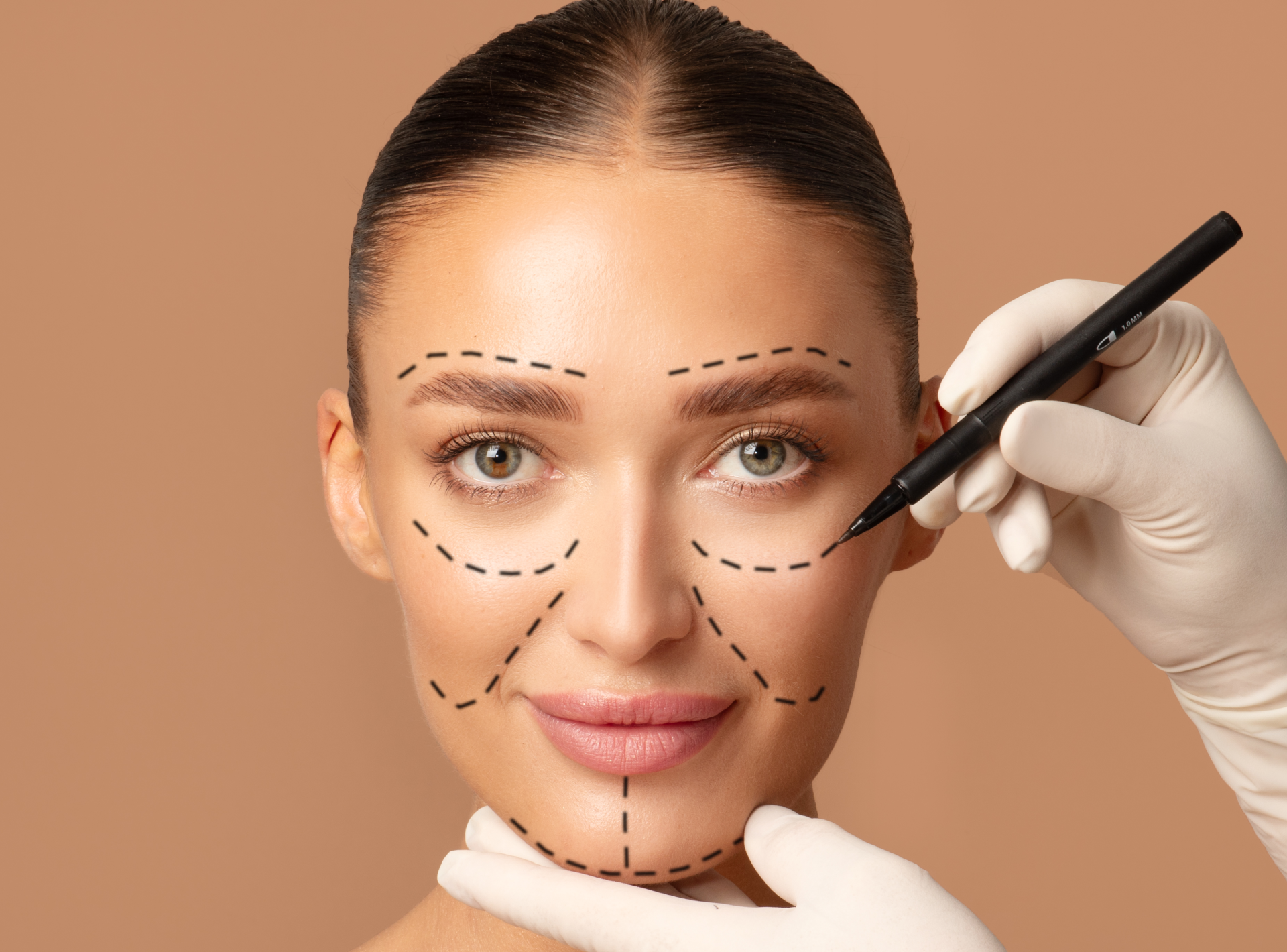 How Safe is Endolift, Really?