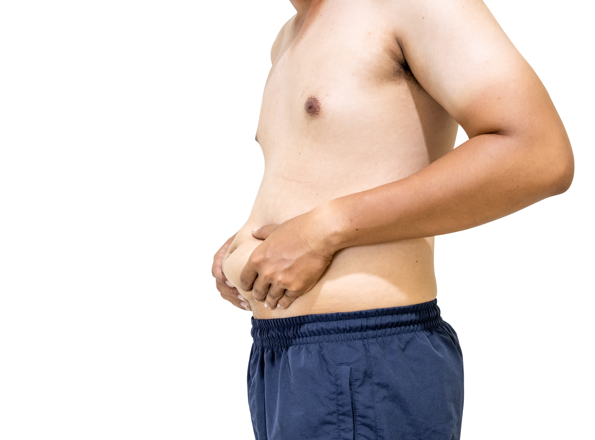 Recover from Excess Skin Removal