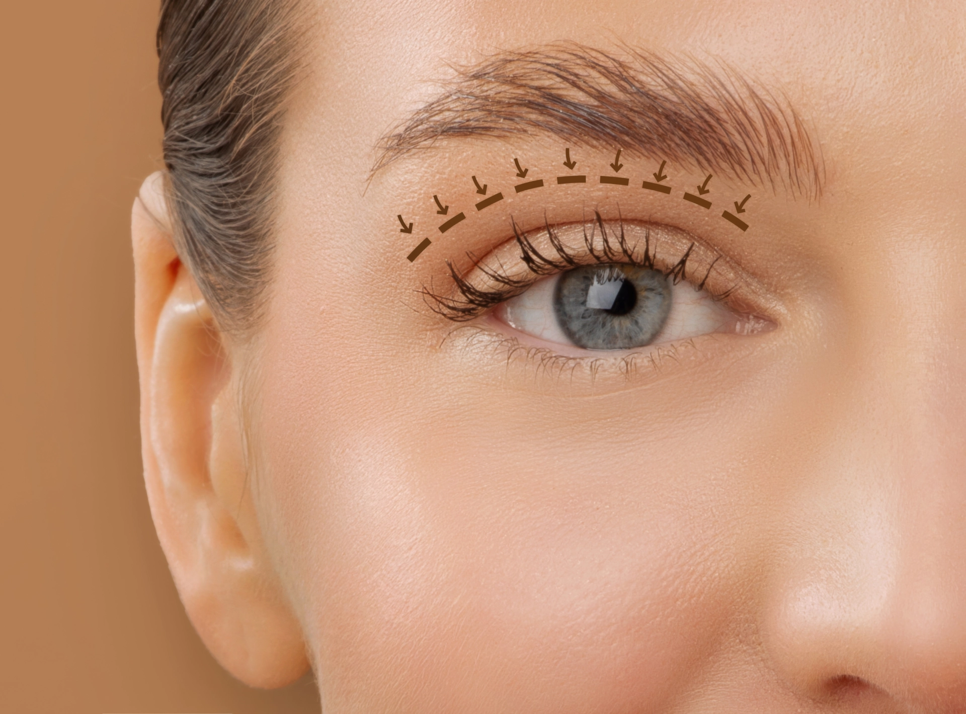 Questions to Ask Your Eyelid Surgeon During Consultation