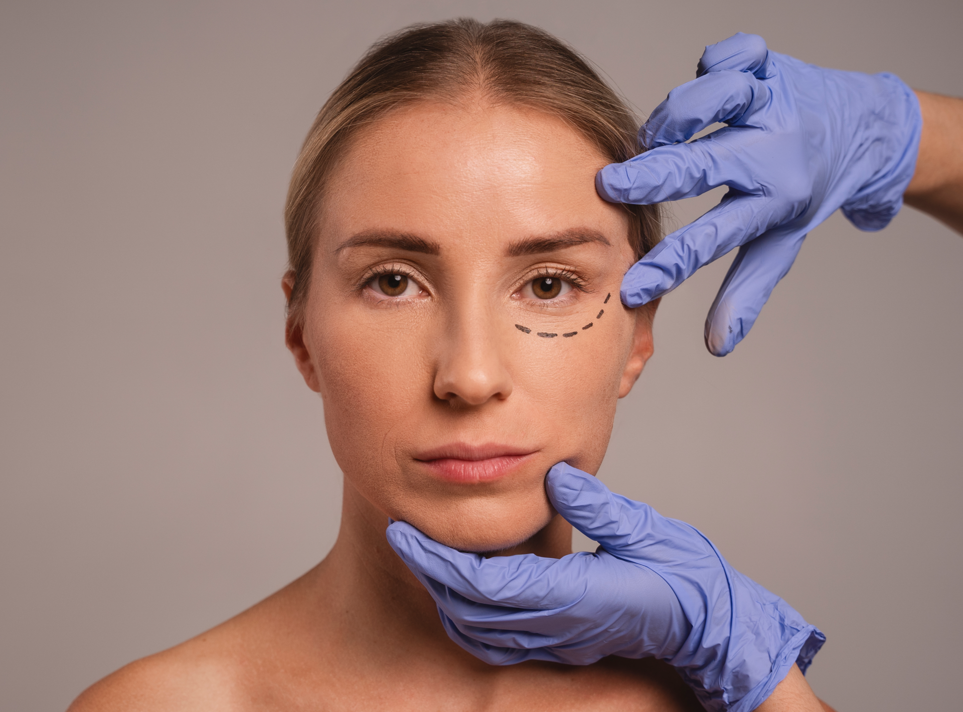 Eyelid Surgery Types: Upper Vs. Lower Blepharoplasty
