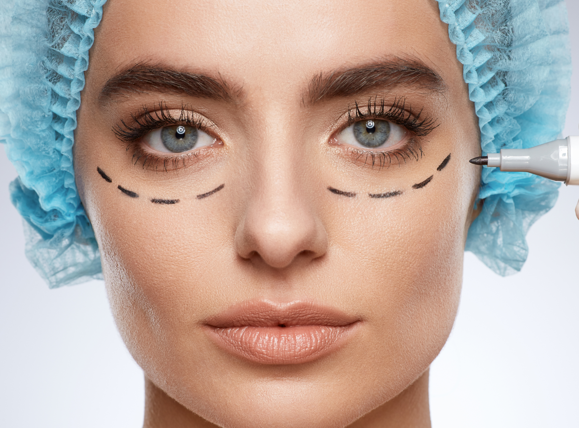 Should I Ask My Plastic Surgeon About Eyelid Surgery