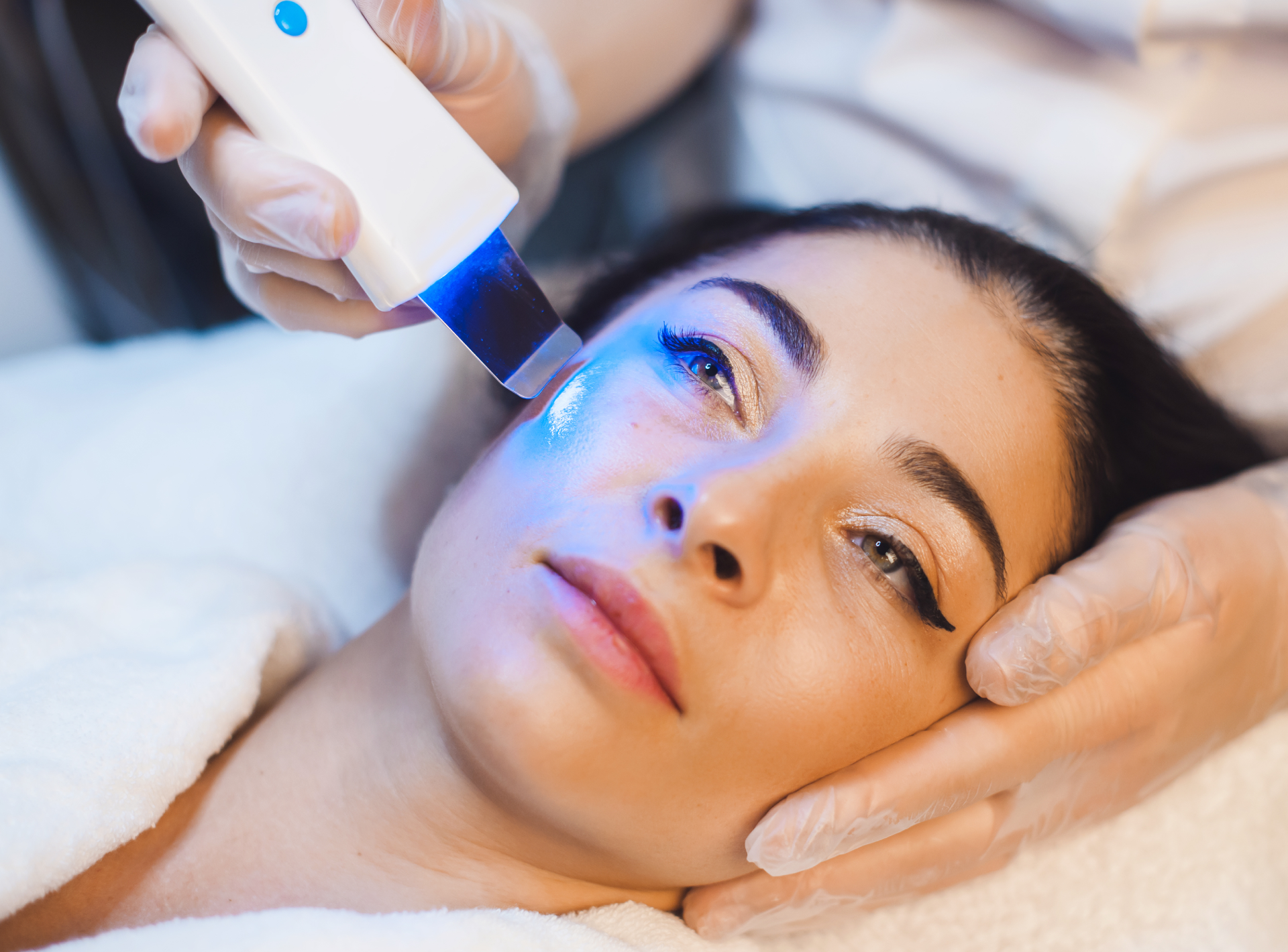 Adverse Reactions to Ipl Therapy