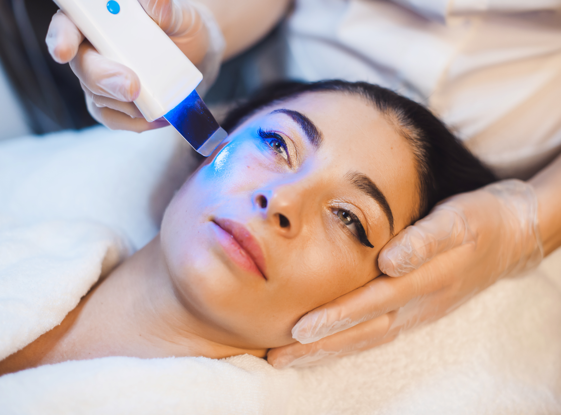 Side Effects of Ipl Treatment
