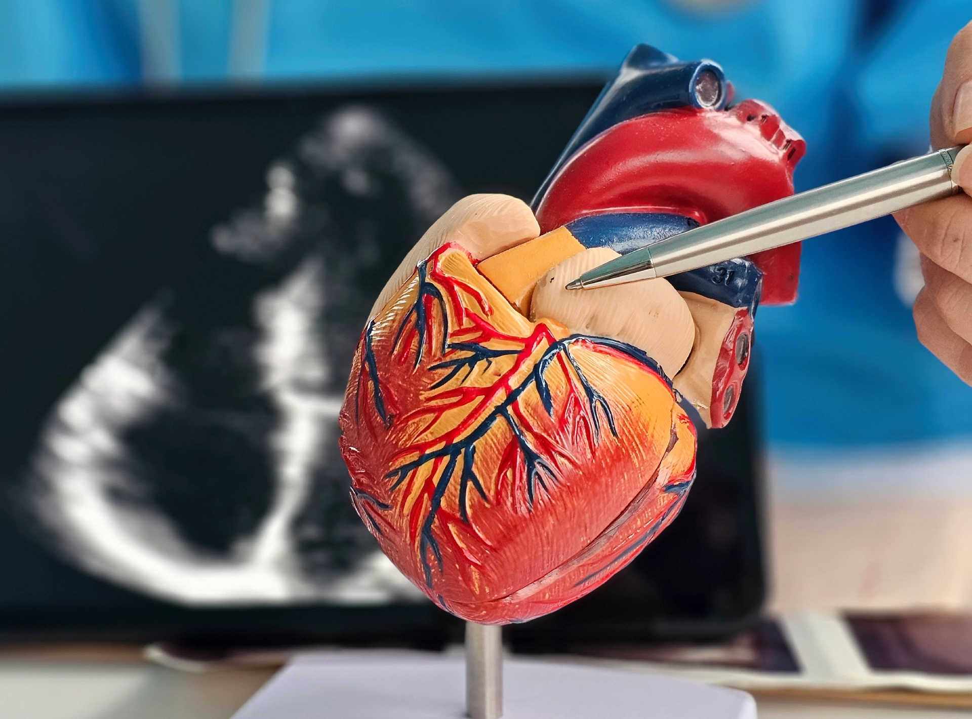 Keyhole Heart Surgery Recovery Time