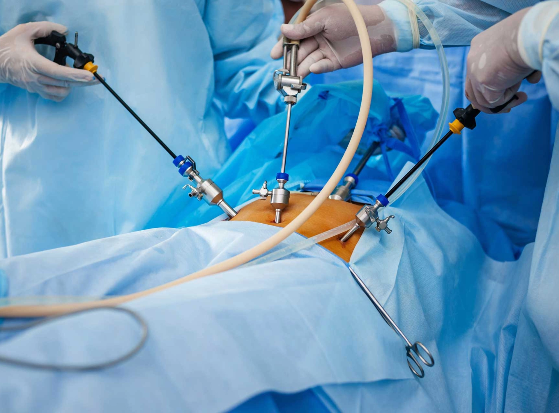 Recovering from Keyhole Surgery