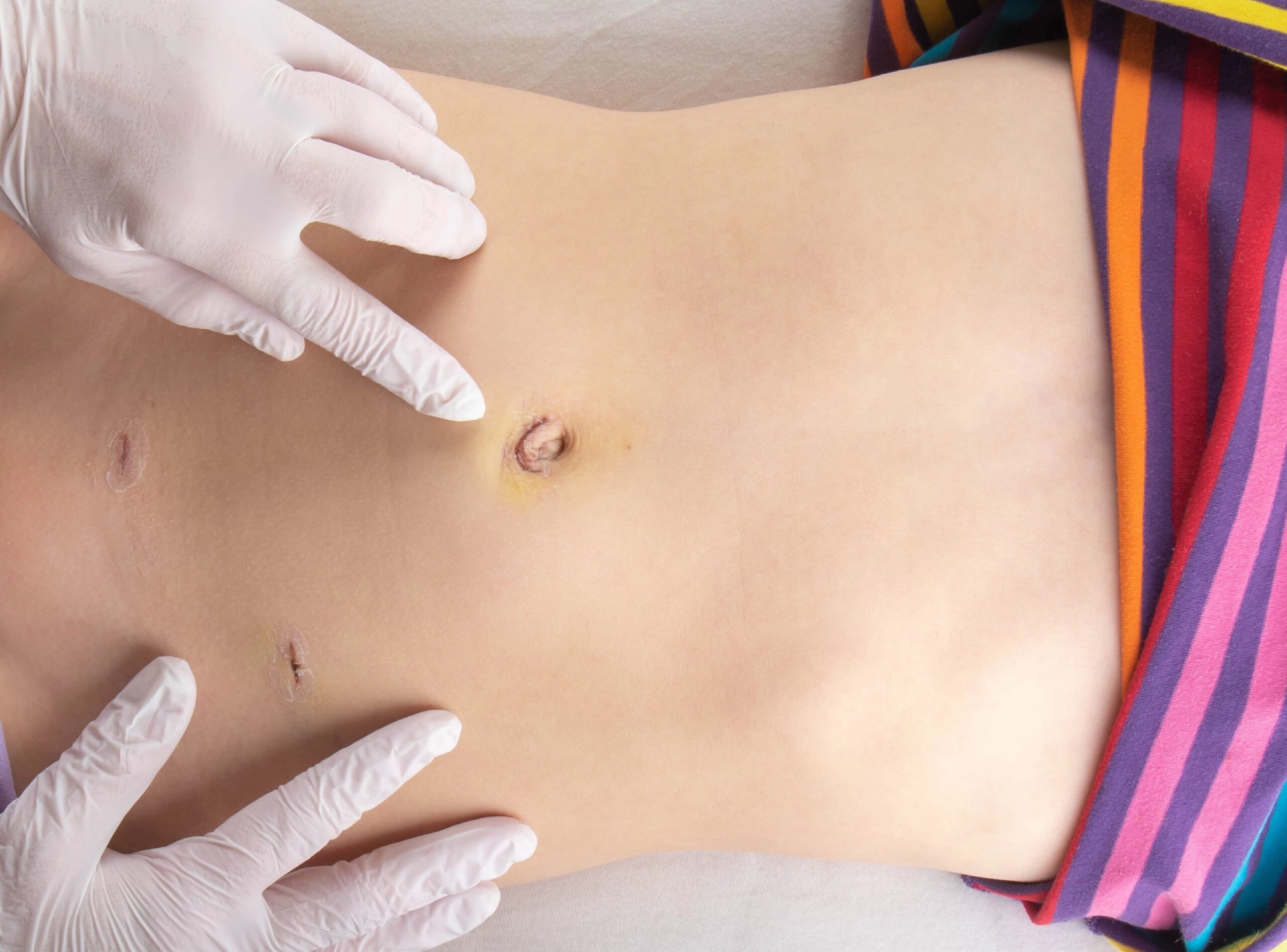 Understanding Laparoscopic Surgery Transforming Health