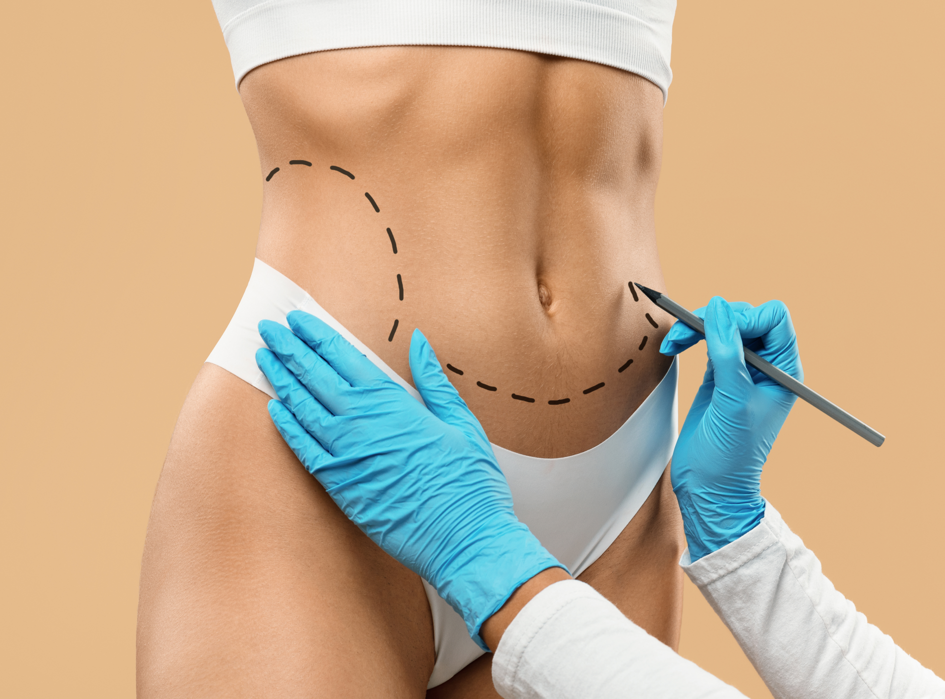 Laser Lipo: Answering Your Faqs