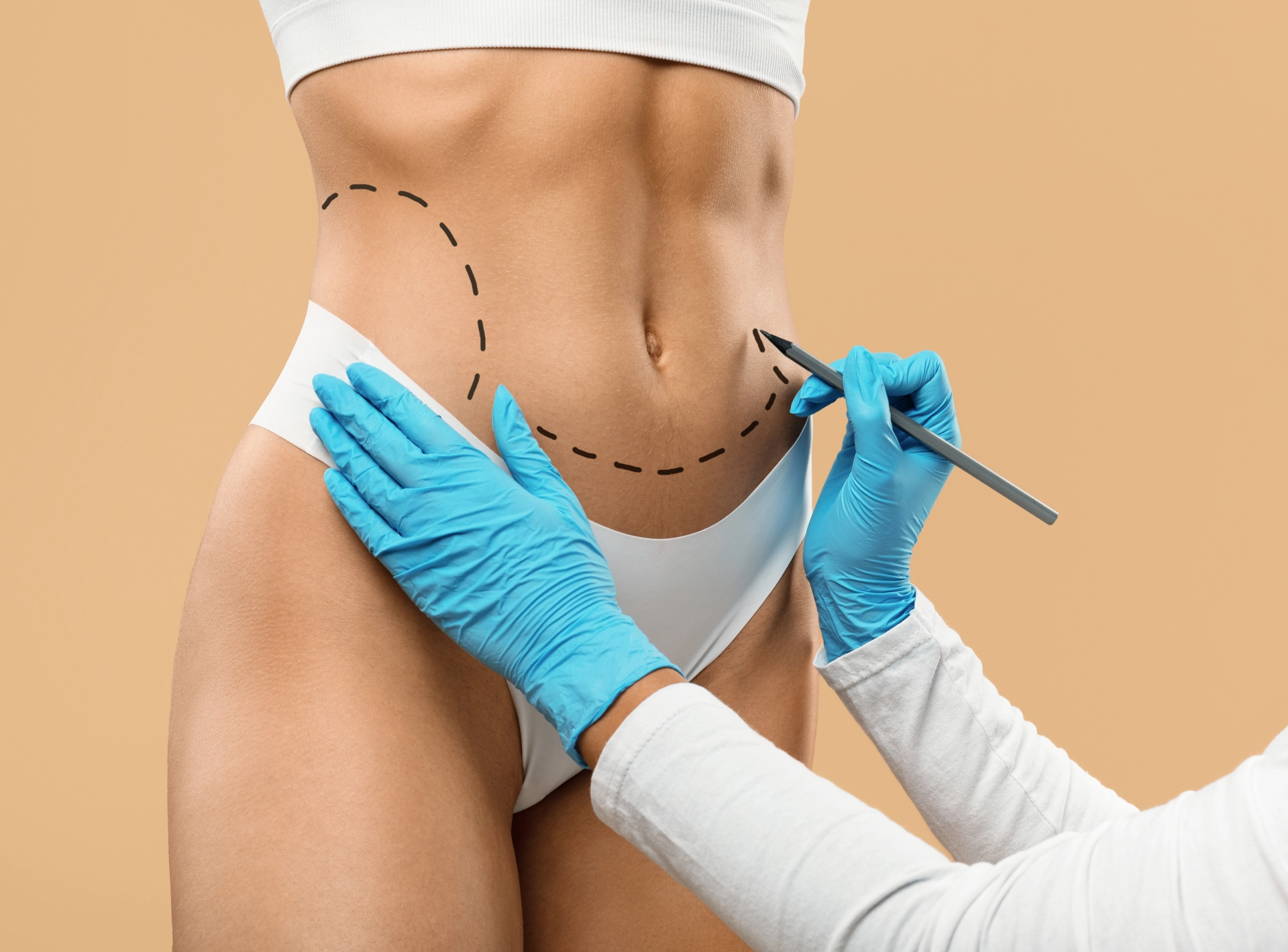 Liposuction for Beginners