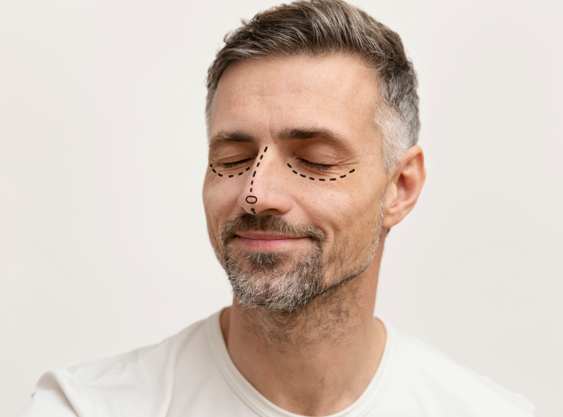 Side Effects of Male Rhinoplasty