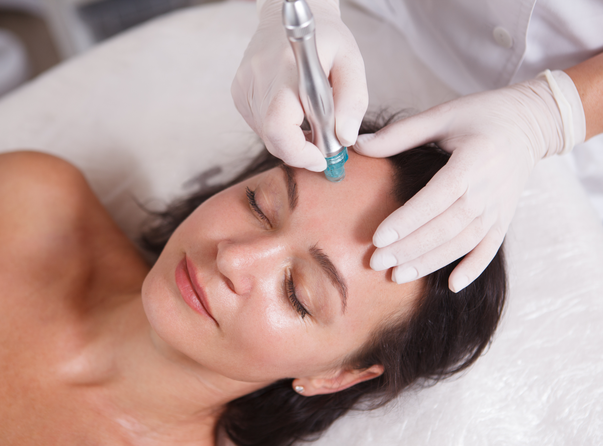 Side Effects of Microneedling