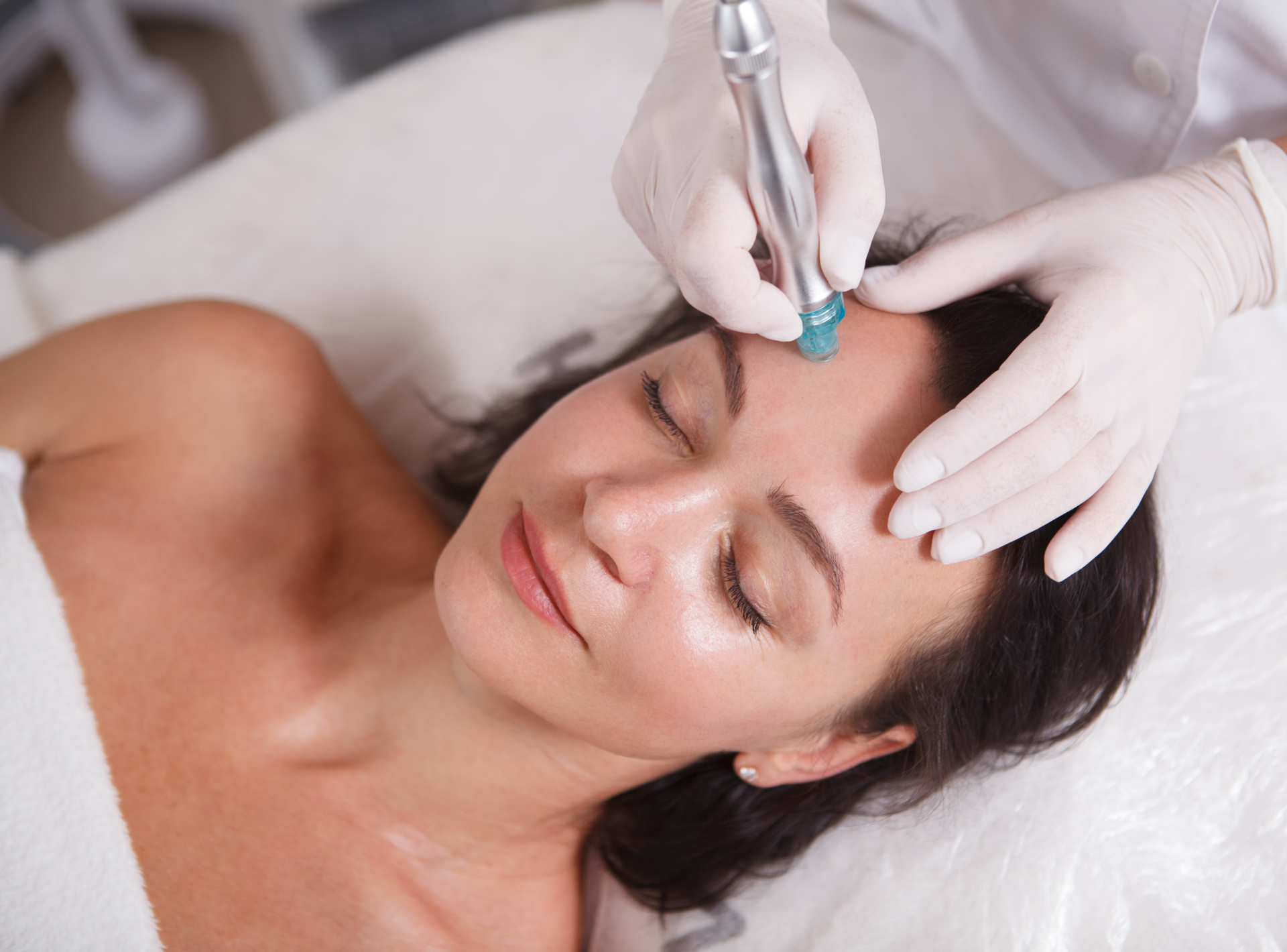 Are There Risks Associated with Microneedling?