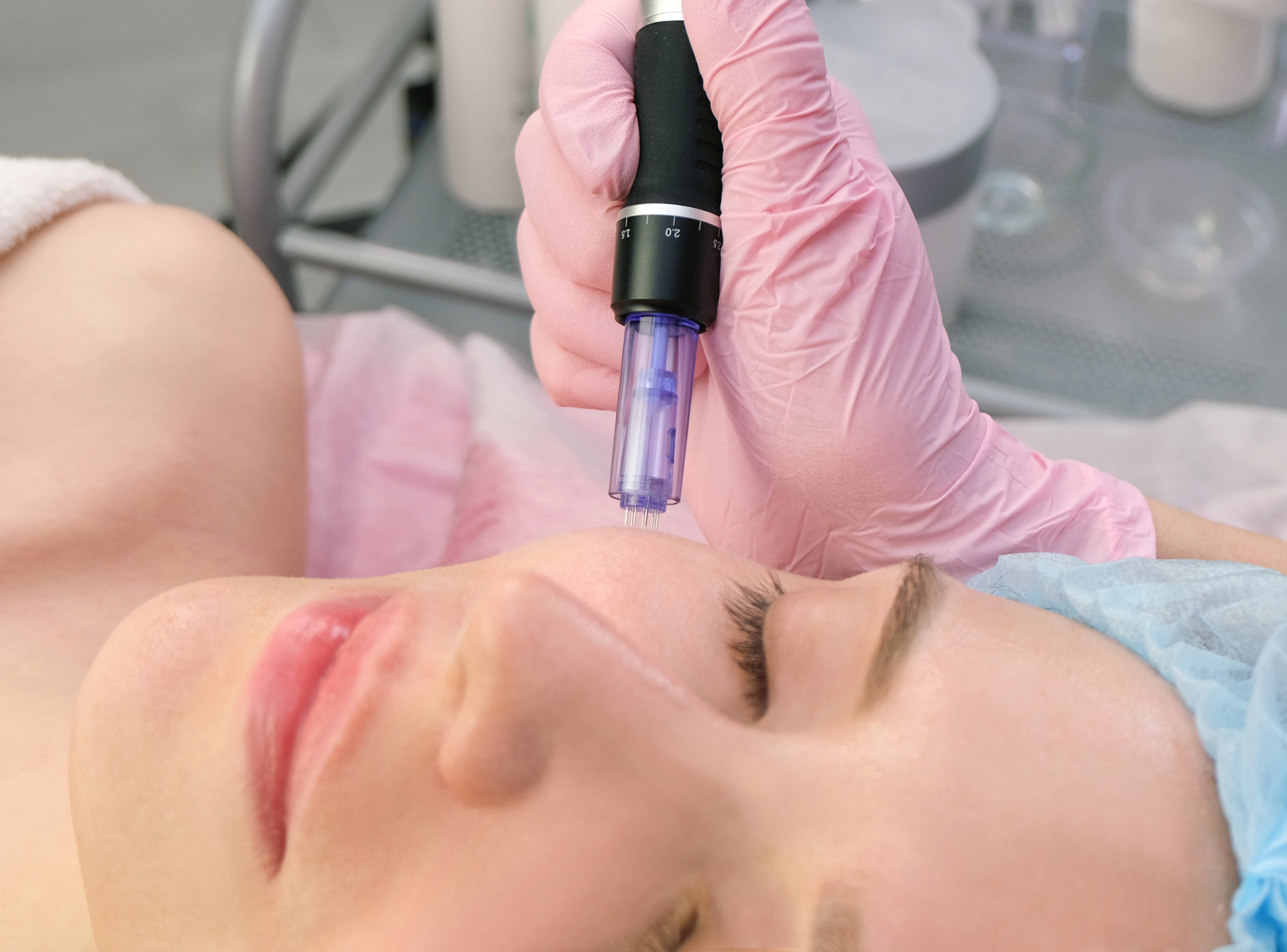 Common Microneedling Side Effects