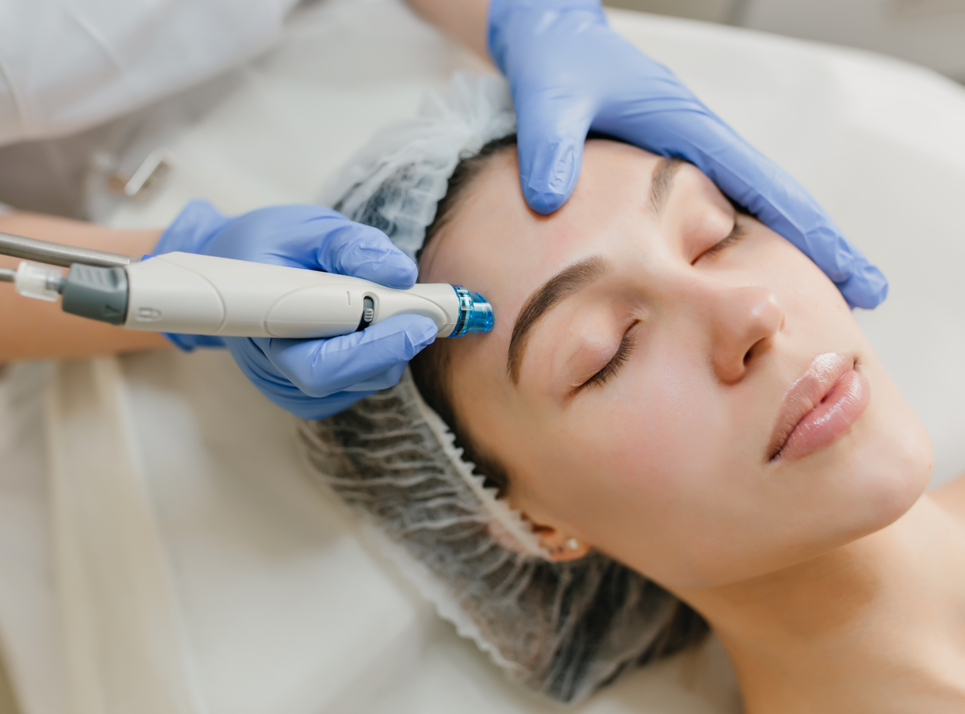 is Microneedling Safe? Risks
