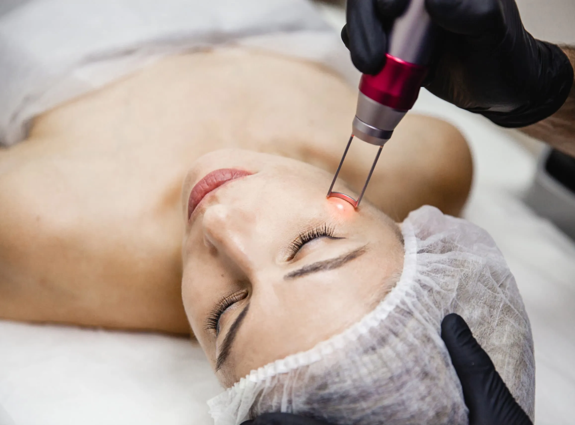 How Long Does It Take To Recover From PicoSure Pro?