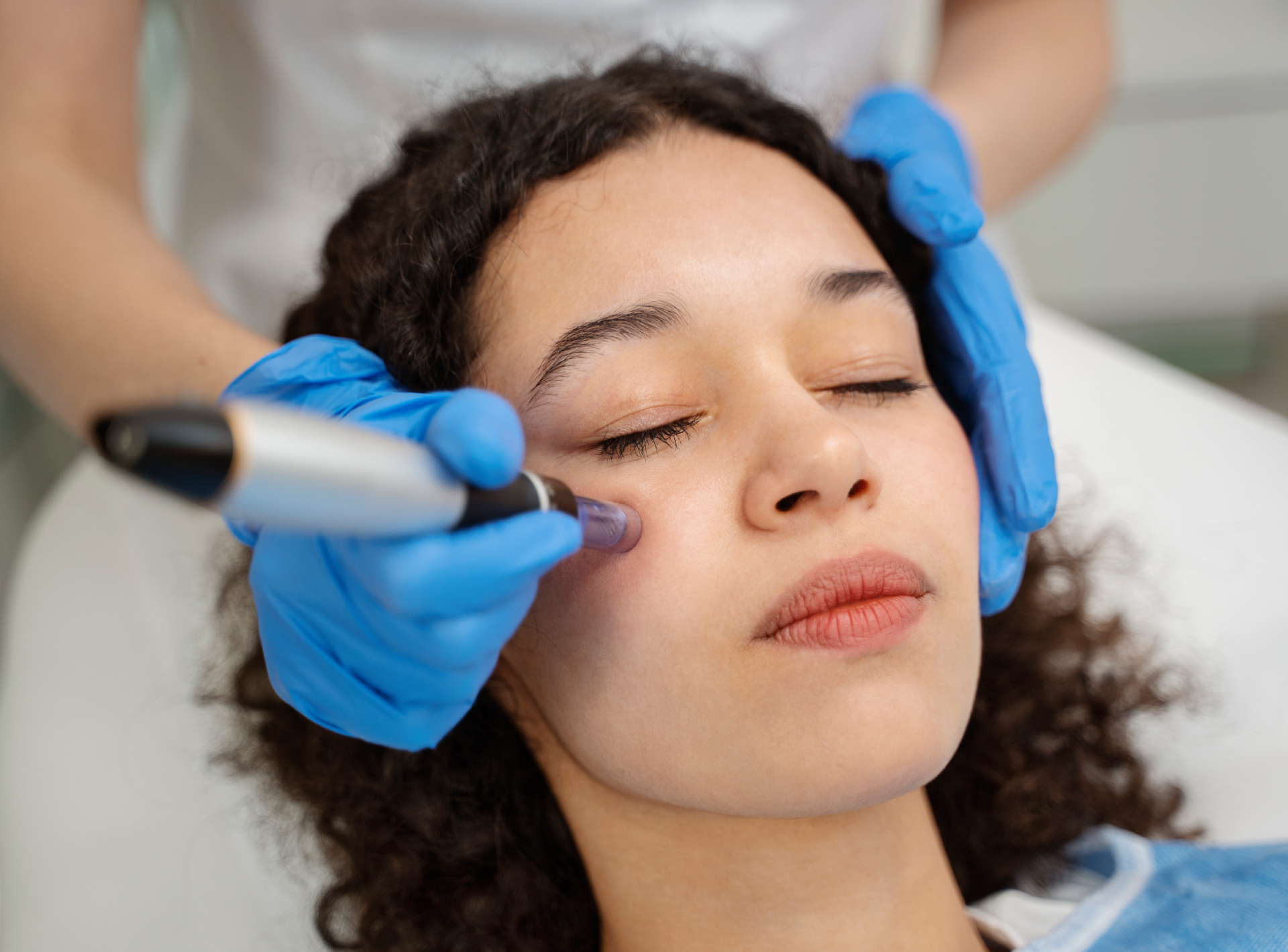Safety Risks of Rf Microneedling