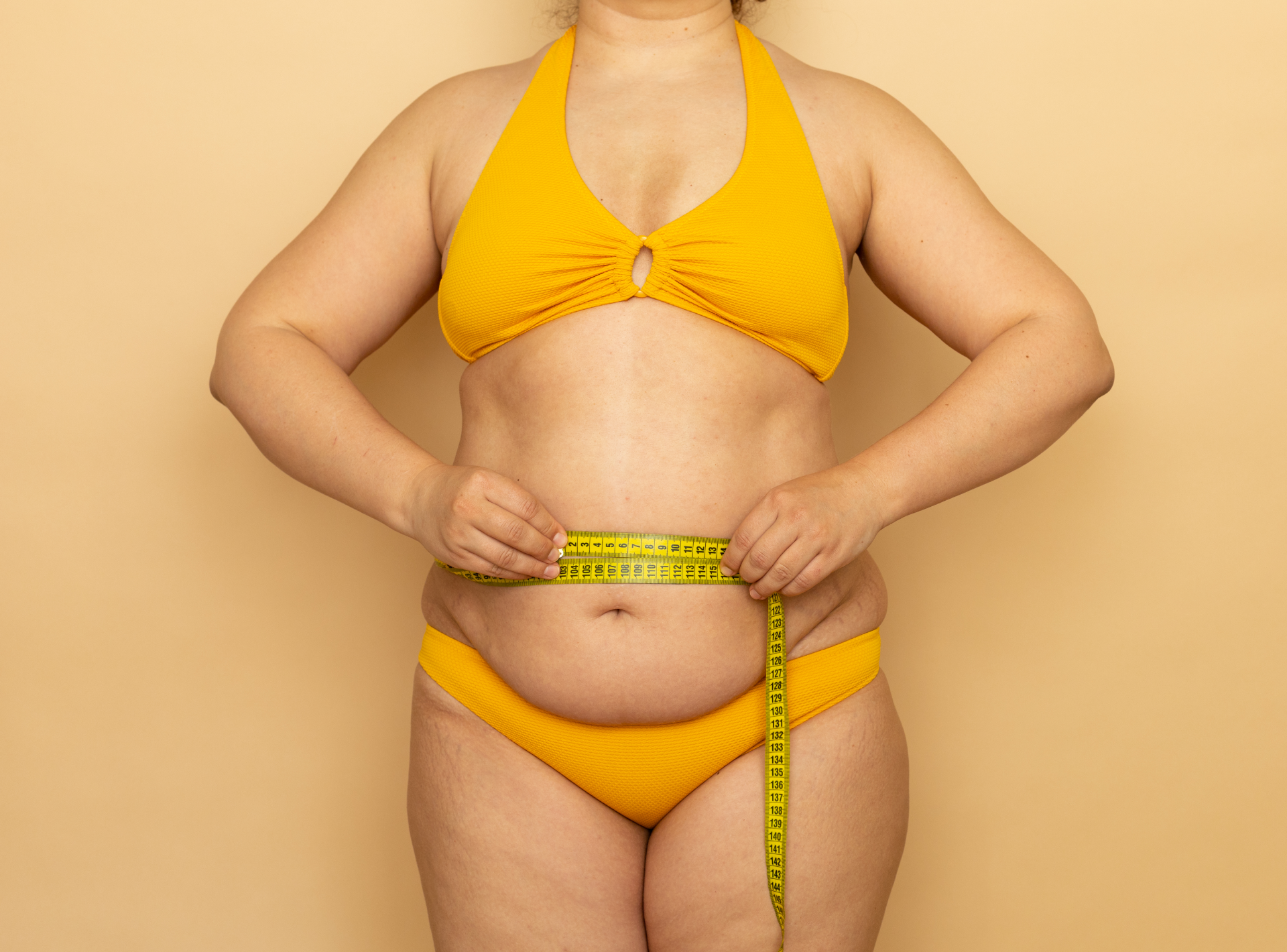 Recover from Weight Loss Surgery