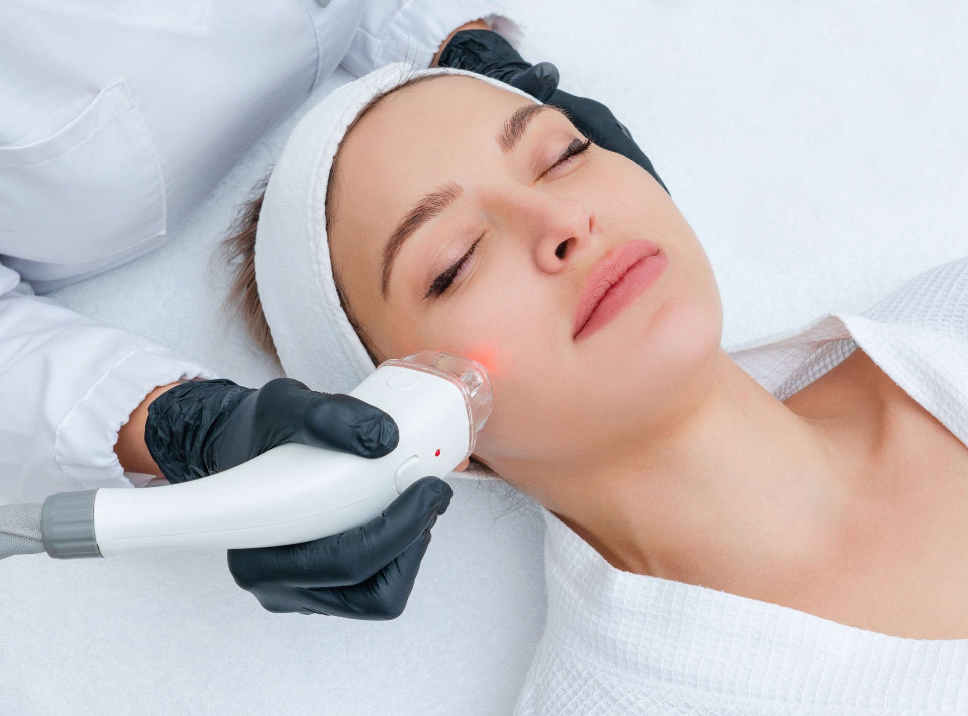 Questions About Fotona Laser Treatment
