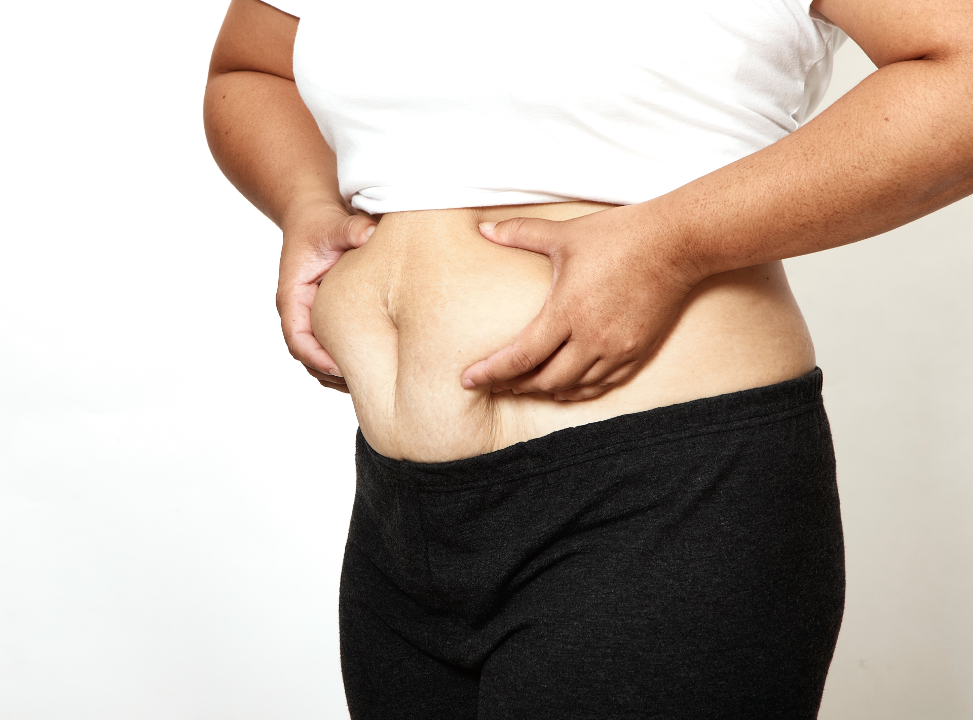 Mini Gastric Bypass Faqs