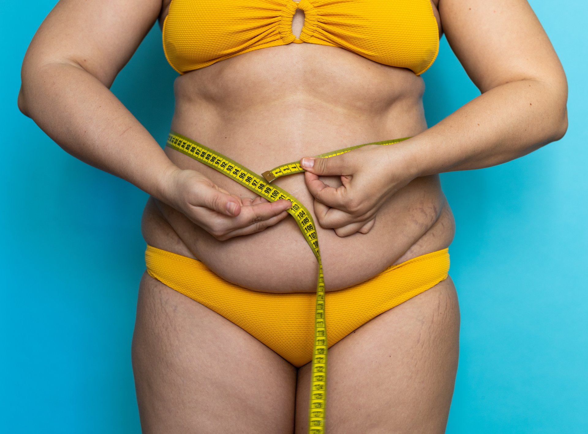 Common Questions from Gastric Sleeve Patients