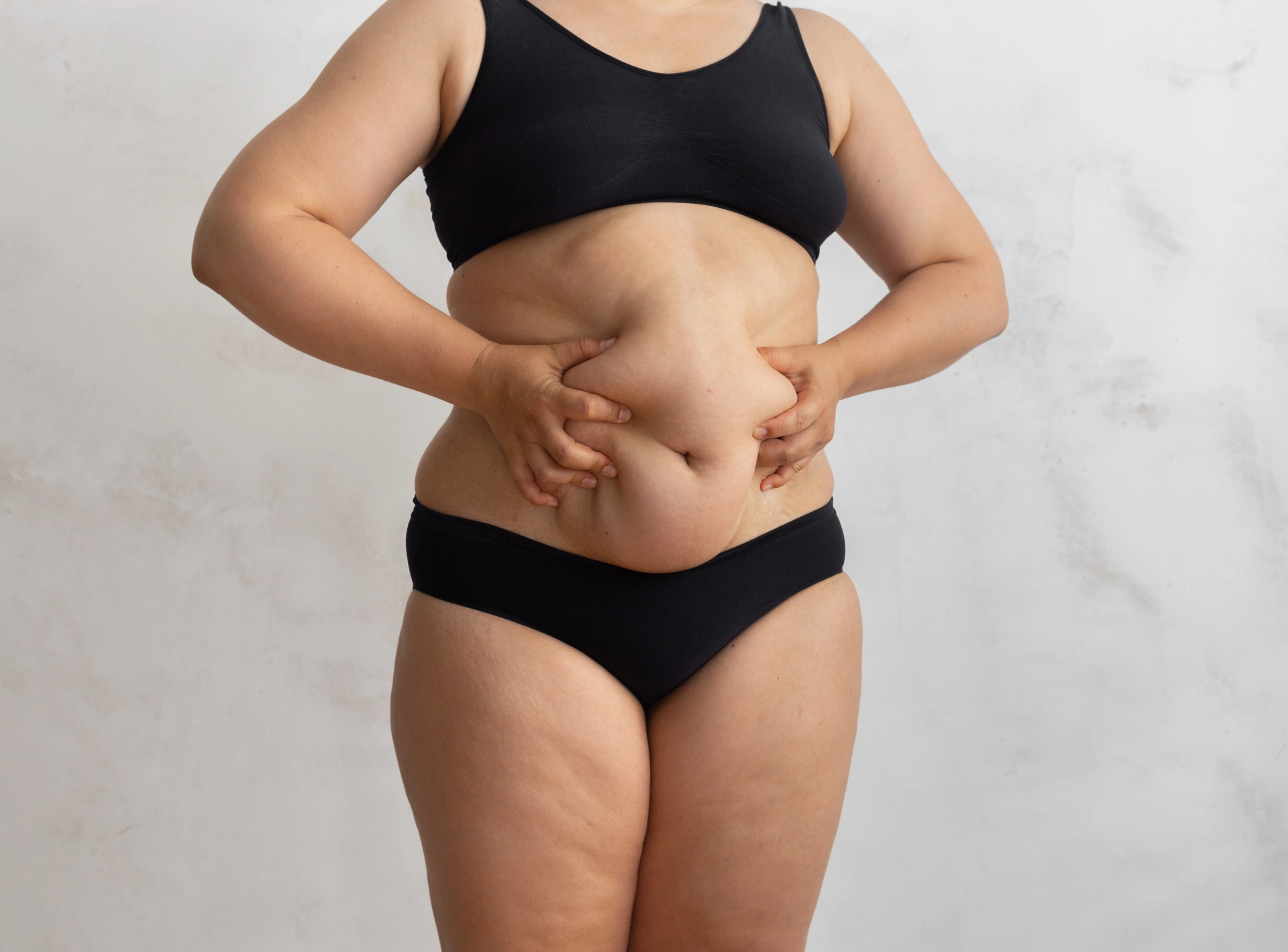 4 Myths of Liposuction