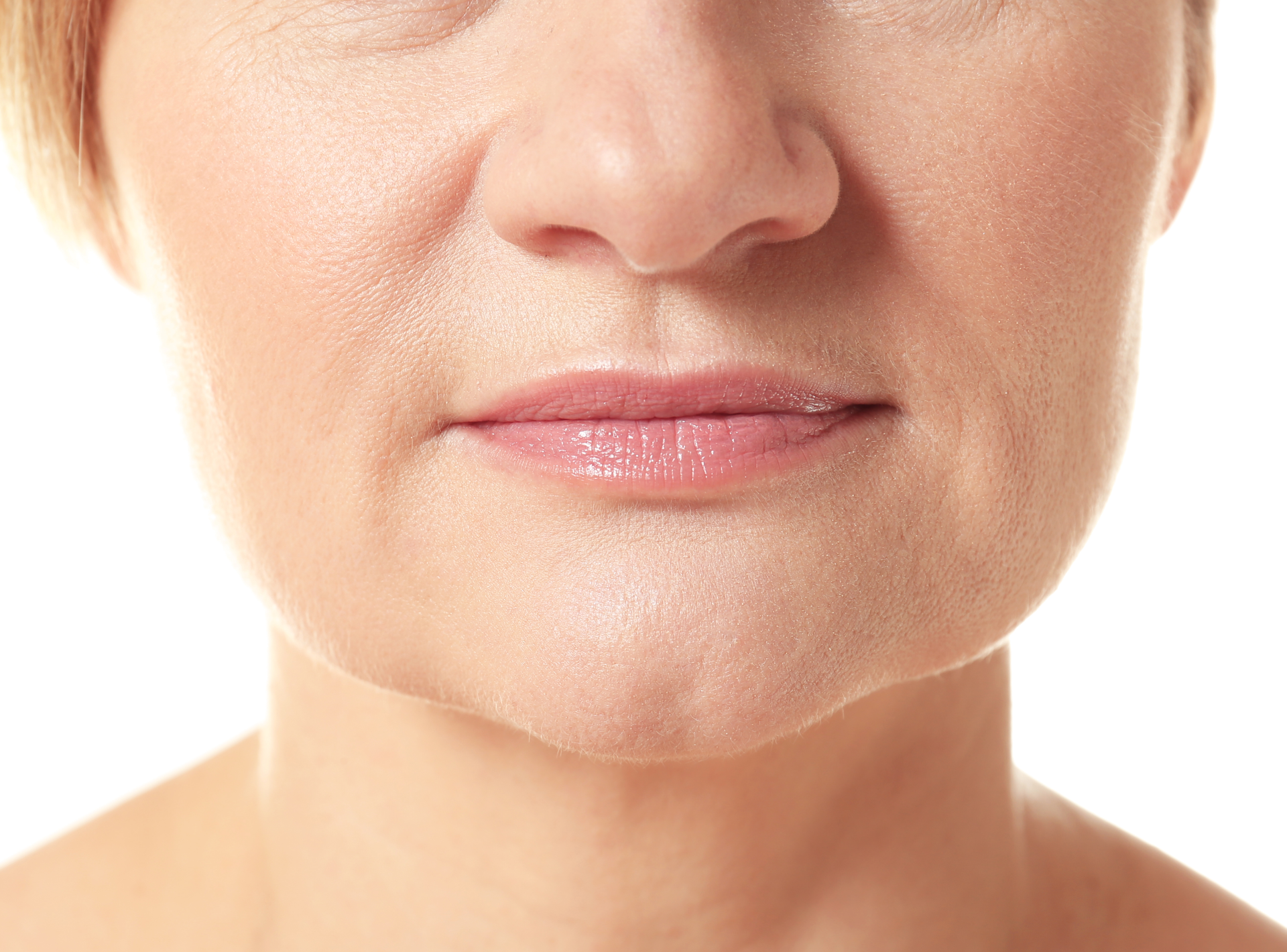 Dermal Fillers for Treating Nasolabial Folds