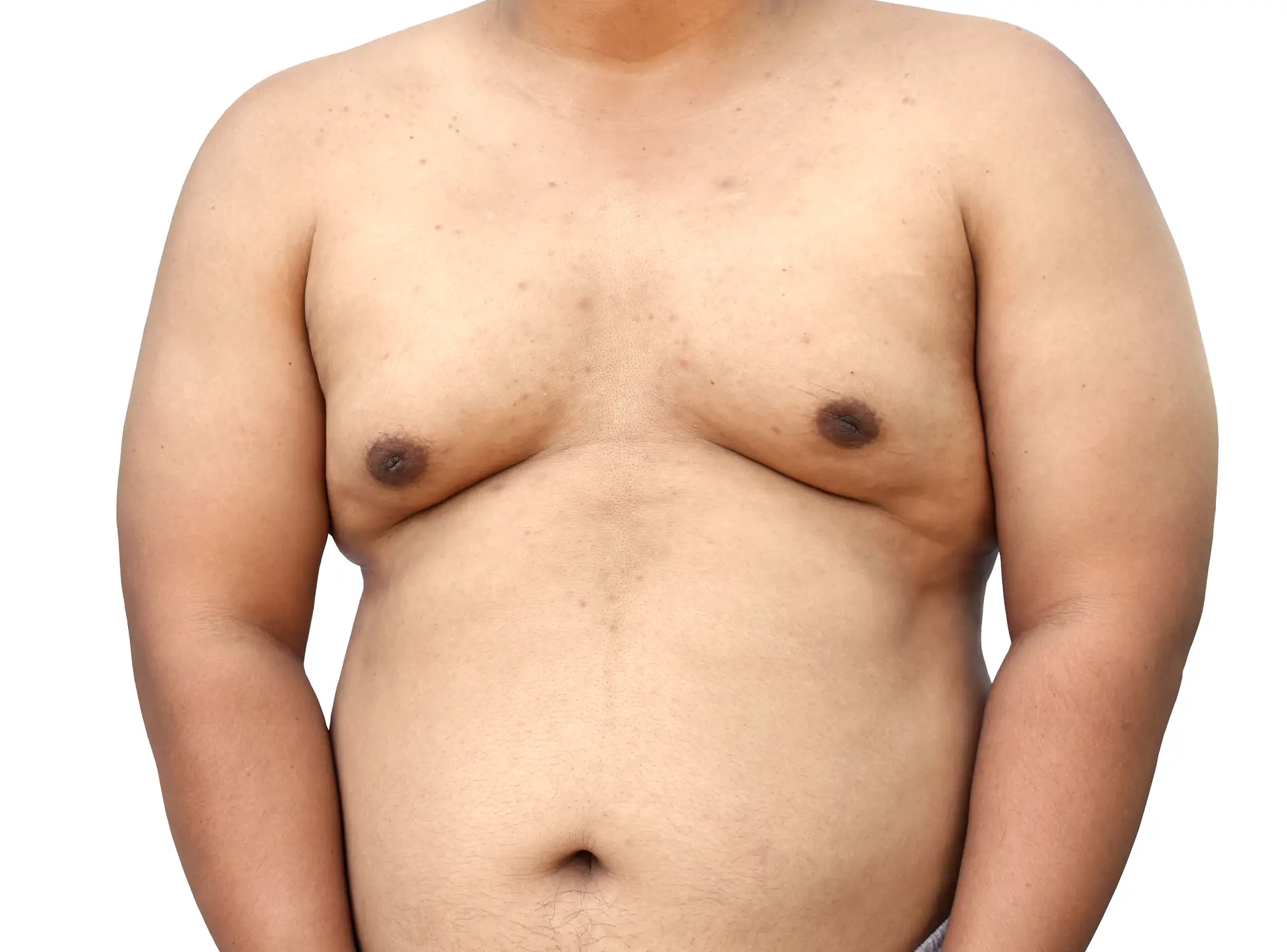 Your Plastic Surgeon Before Getting Pectoral Implants