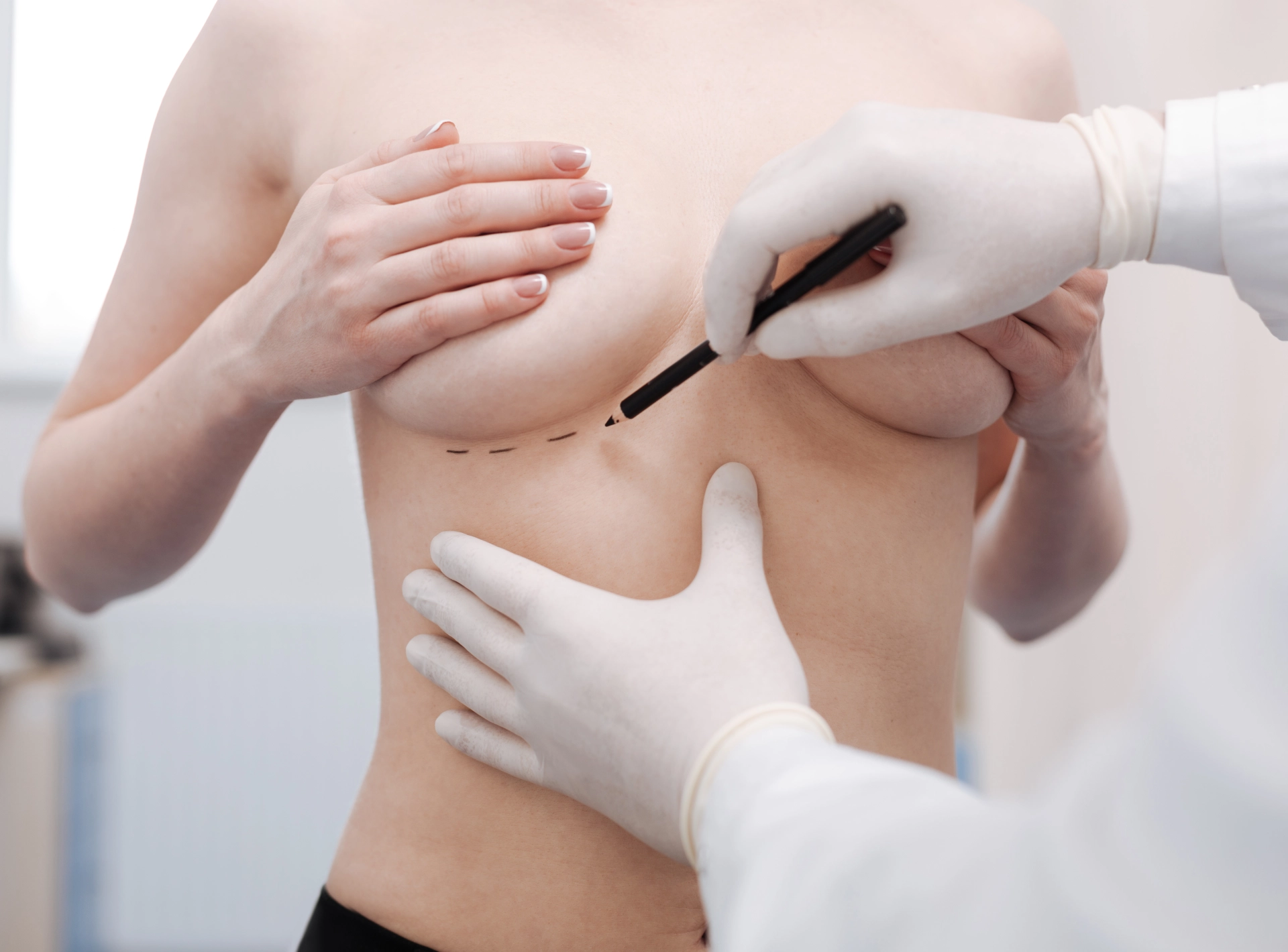 Expert Tips for Breast Augmentation Scars