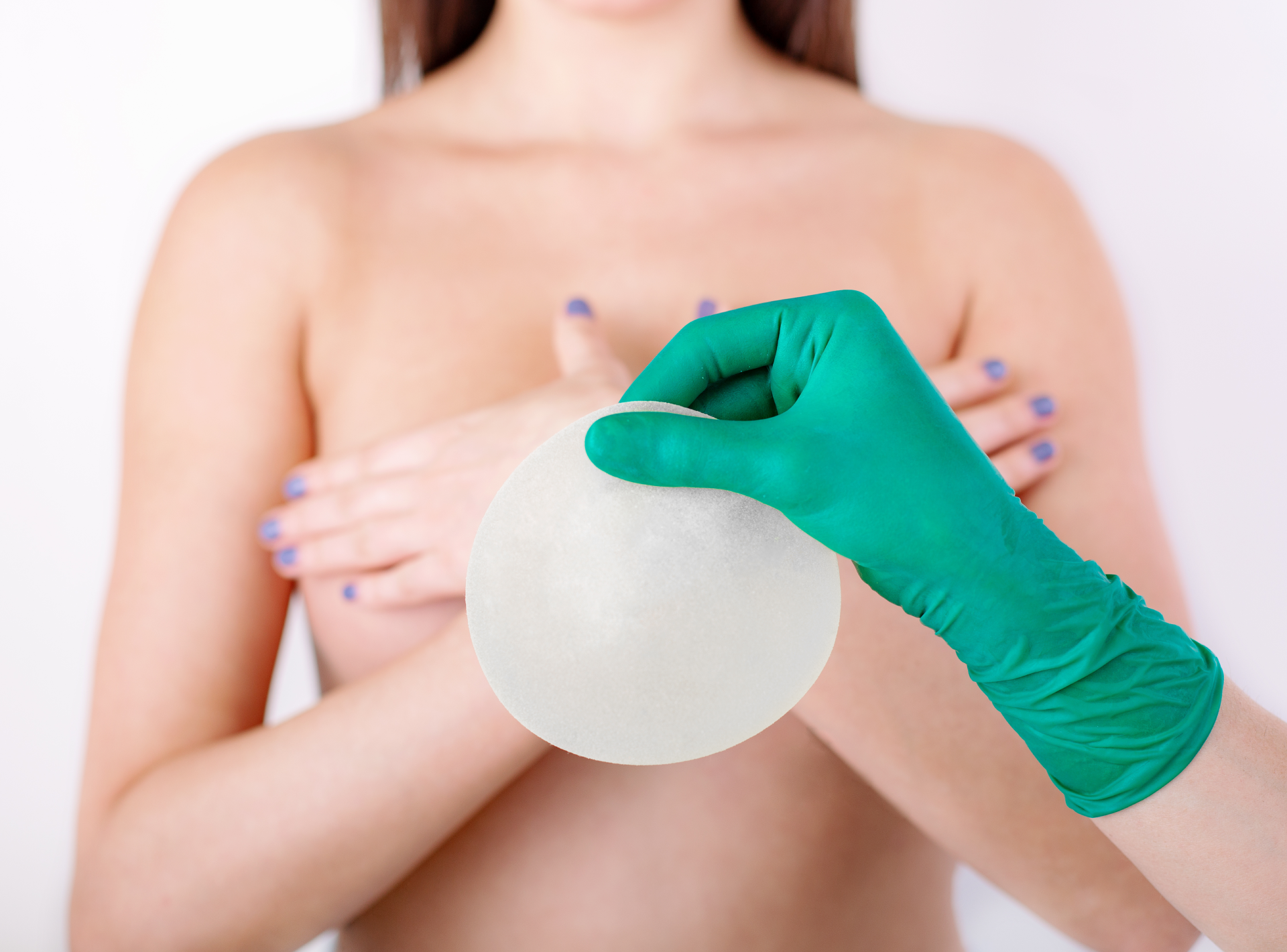 Breast Implant Removal Questions to Ask