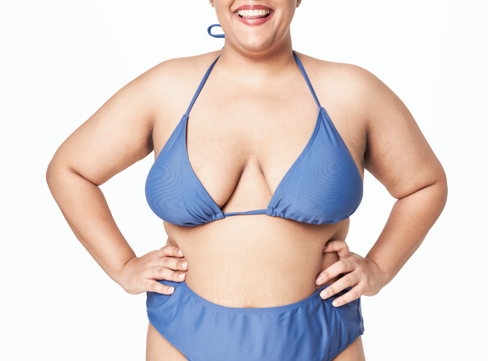 Breast Lift Treatment for Sagging Breasts
