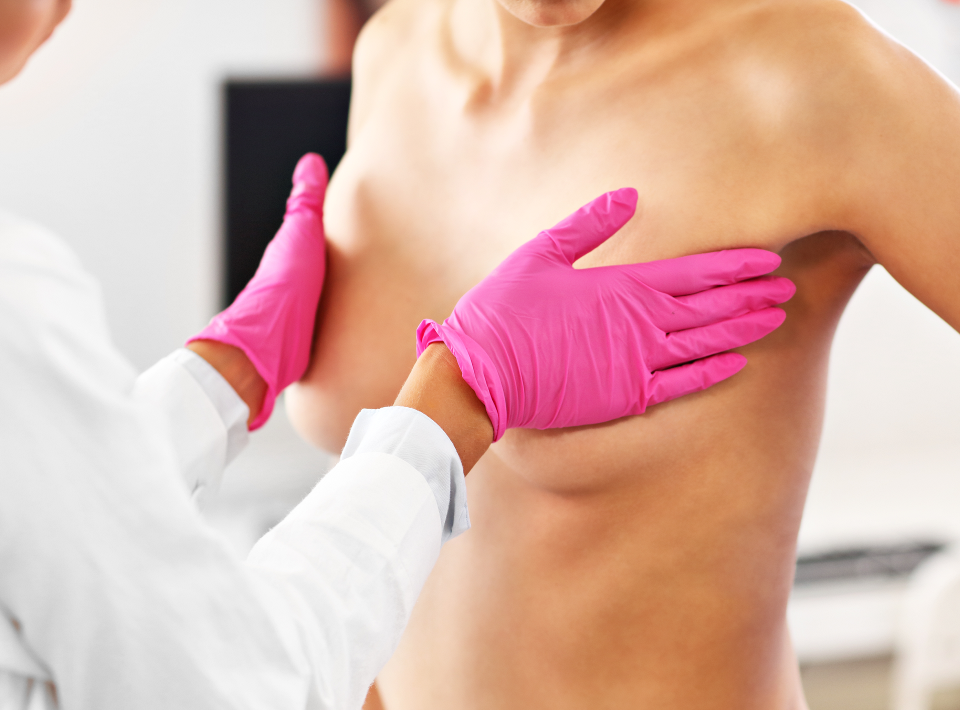 What Questions Should I Be Asking My Breast Reconstruction Surgeon?