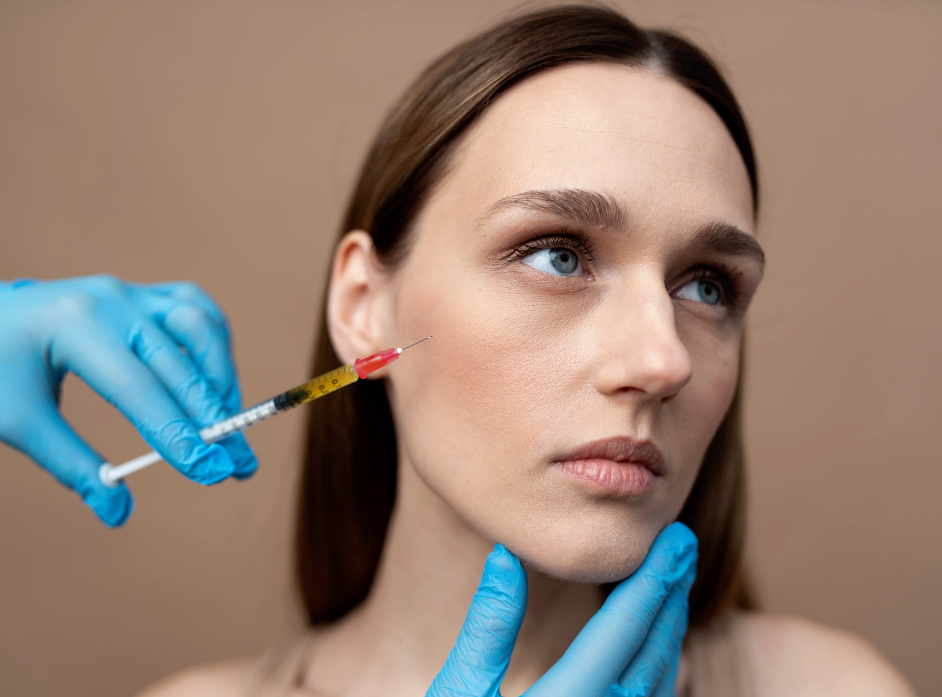 Bruising After Cheek Fillers