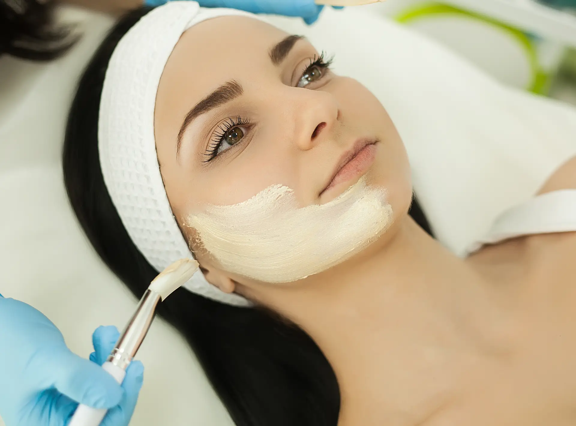 What is Chemical Peel Treatment? is It Good