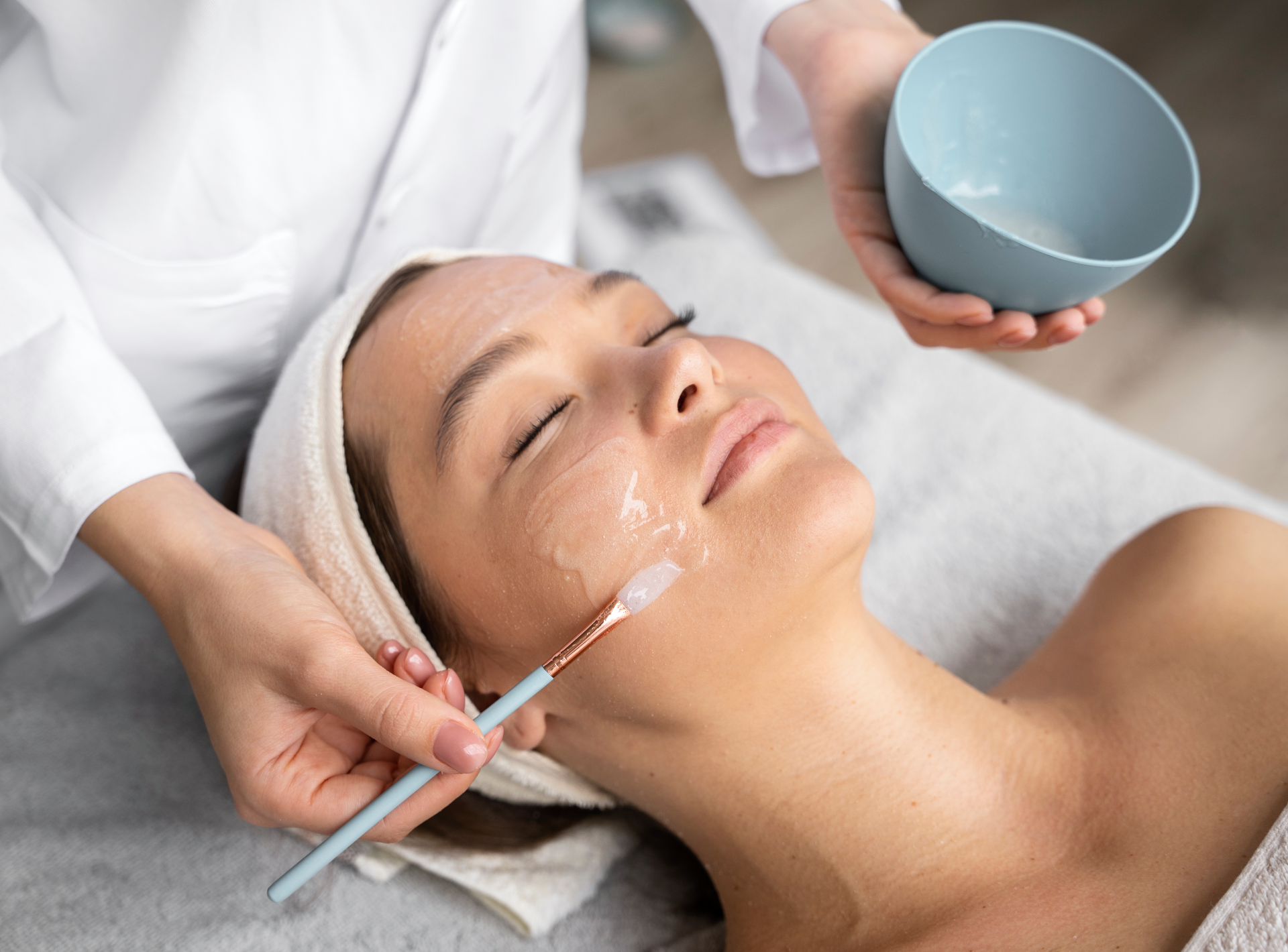 Do Chemical Peels Help with Melasma?