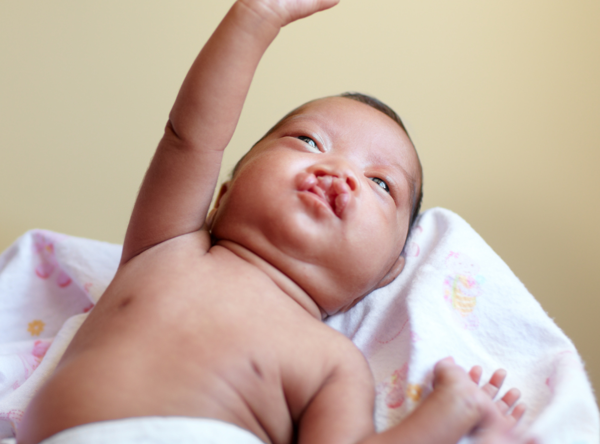 Complications of Cleft Lip and Palate Surgery