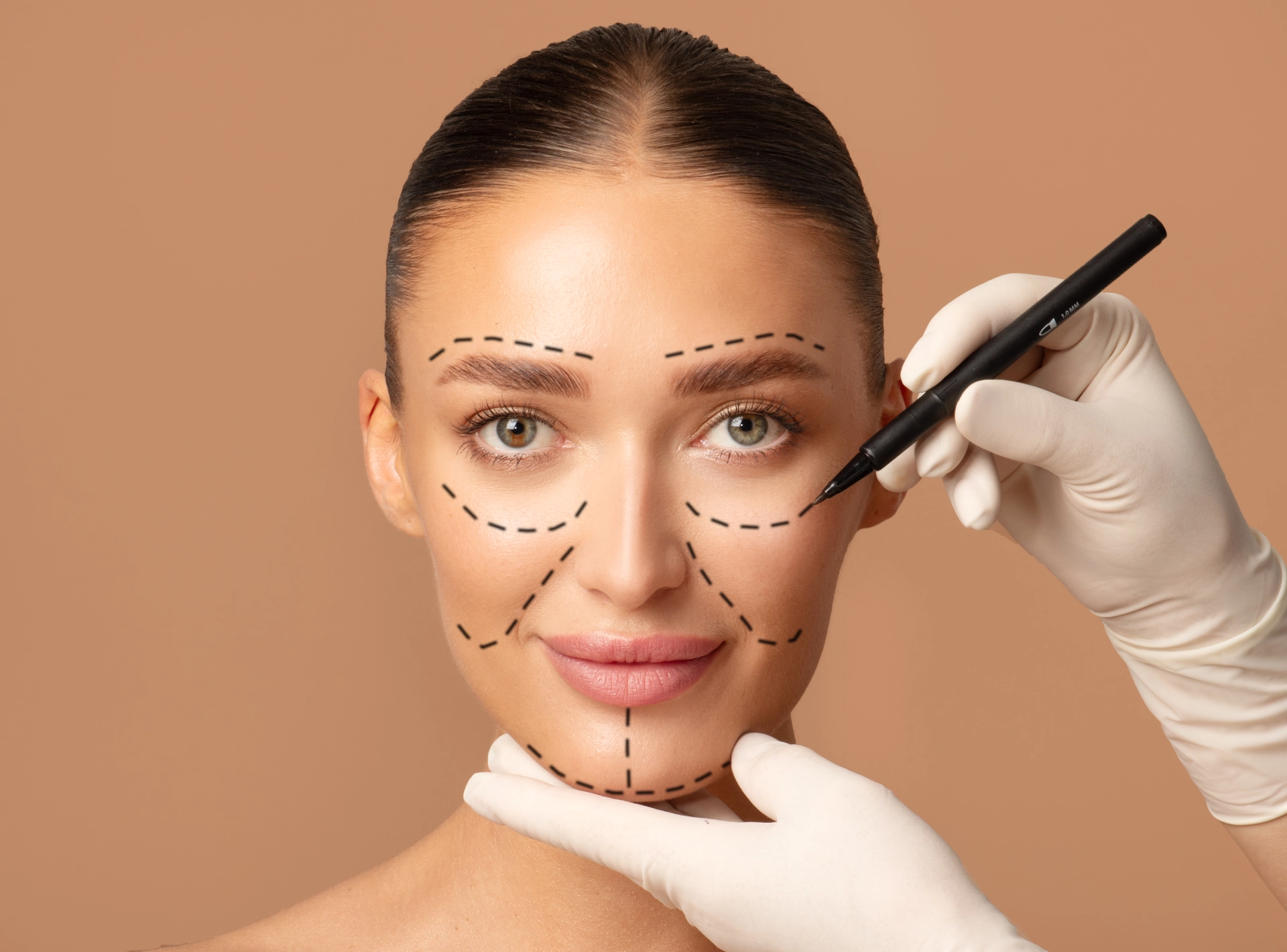 Who Needs a Deep Plane Facelift?